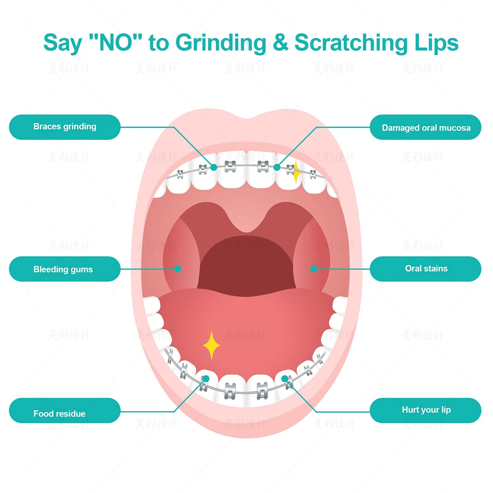 Annhua Annhua Orthodontist Braces Wax Ortho Dots 10 Pack for Aligners, Braces Wearer, Brackets, Invisible-lingers, Dental Orthodontic Wax Strips White - Unscented & Flavorless