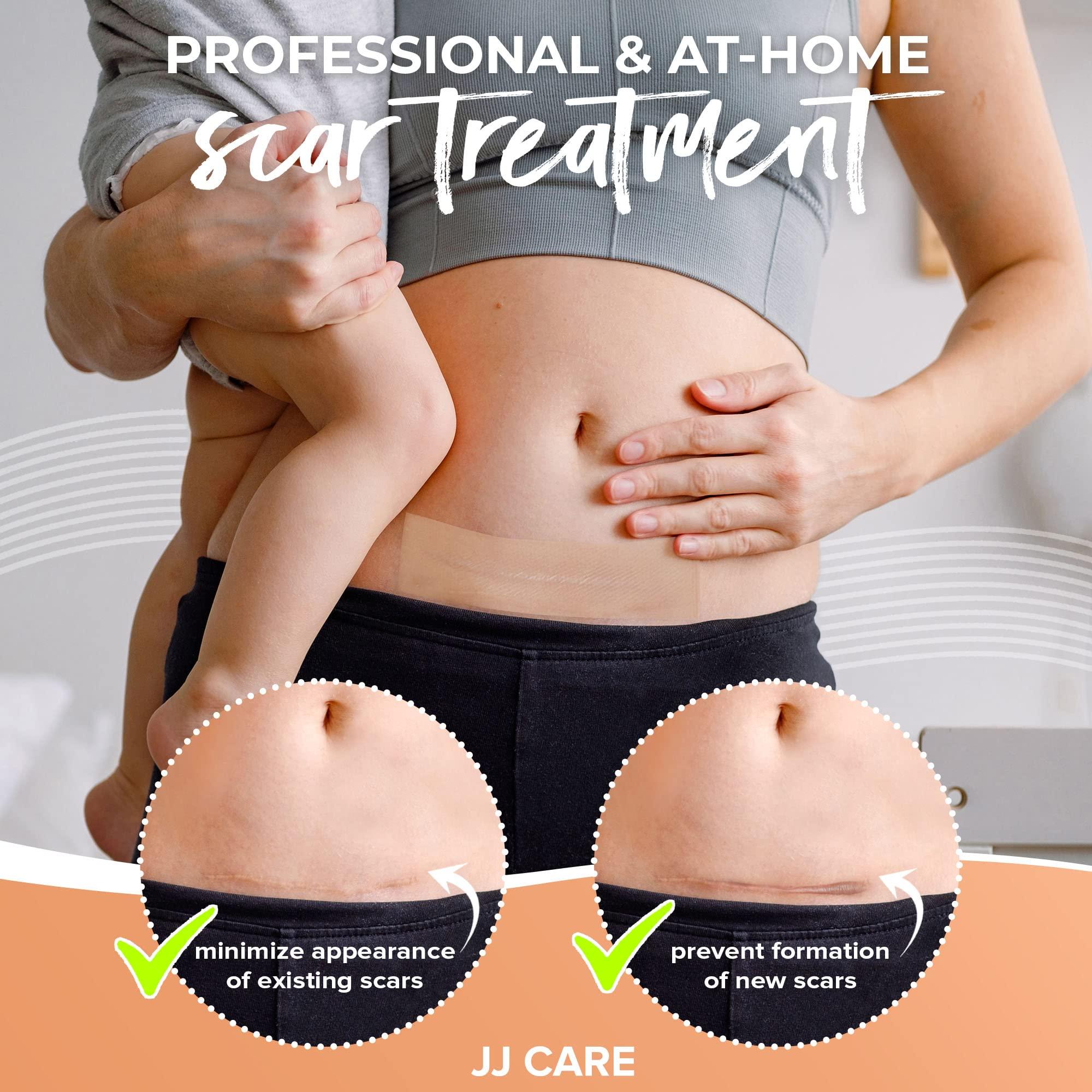 JJ CARE Soft Silicone Tape, 1.6” x 120” Flexible Silicone Scar Tape, Medical Grade Silicone Strips for Scars, Washable & Reusable Scar Tape for Surgical Scars, Latex-Free Scar Tape