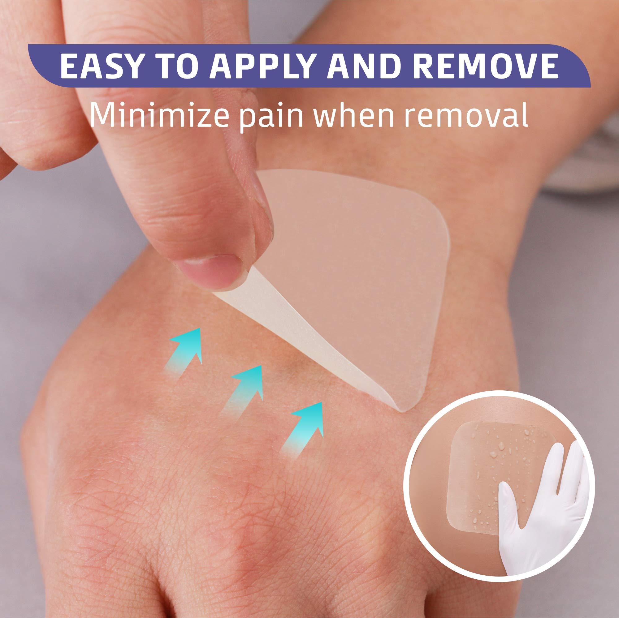 Conkote Conkote Hydrocolloid Wound Dressing 4”x 4”, Sterile Adhesive Patches, Box of 10 Dressings