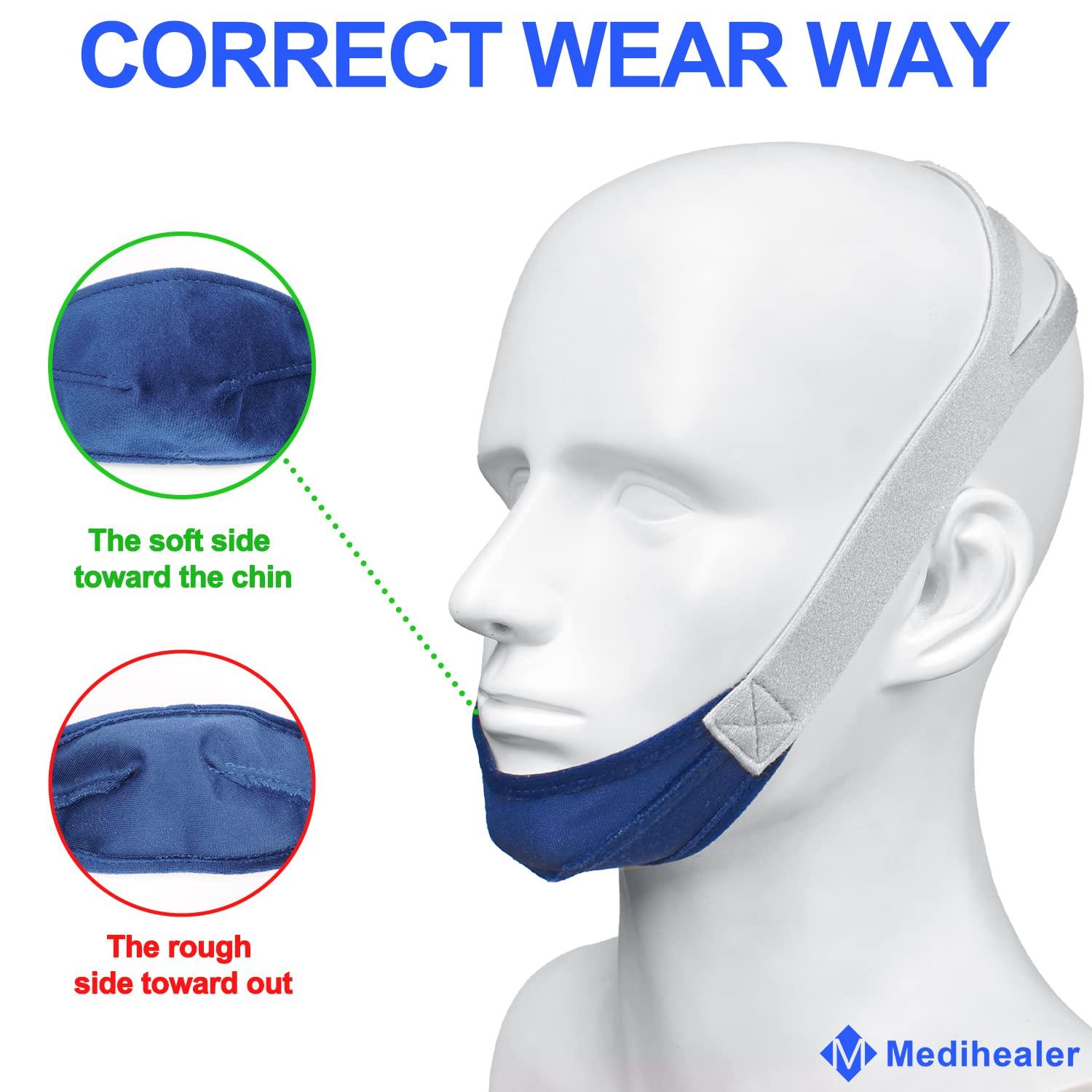 Medihealer 2 Packs Chin Straps for Users and Mouth Breathers - Anti Snoring Chin Strap for Men and Women,Chin Straps to Reduce Air Loss, Instant Mouth-Snoring Relief, Great Value Supplies by Medihealer.