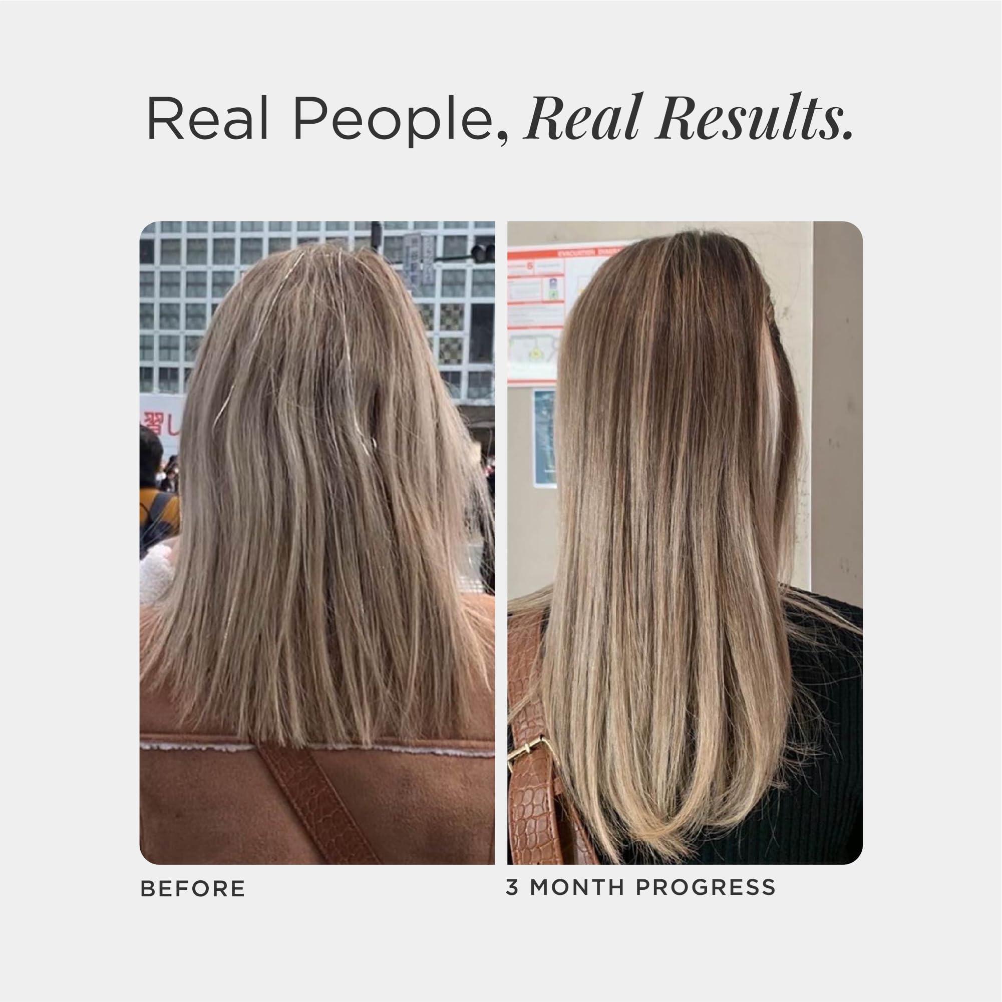 JSHealth JSHealth Vitamins Hair and Energy Formula - Hair & Scalp Support Supplement with Iodine and Zinc - 30 Capsules