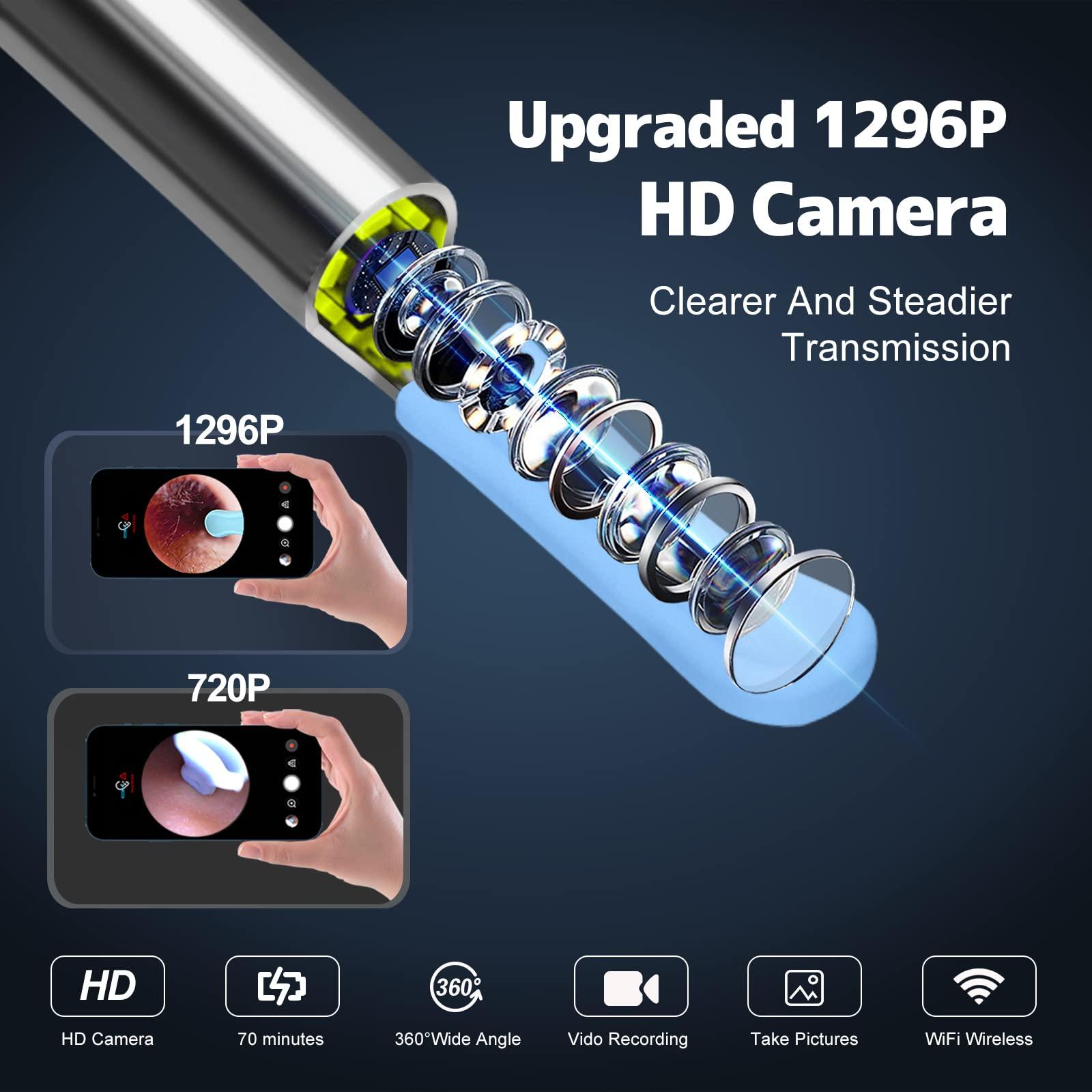 Right Ear Wax Removal, Ear Cleaner with Camera and Light, Ear Wax Removal Kit with 1296P Otoscope, Ear Cleaning Tool with 6 Ear Spoon, Ear Camera for iPhone & Android Phones,Black