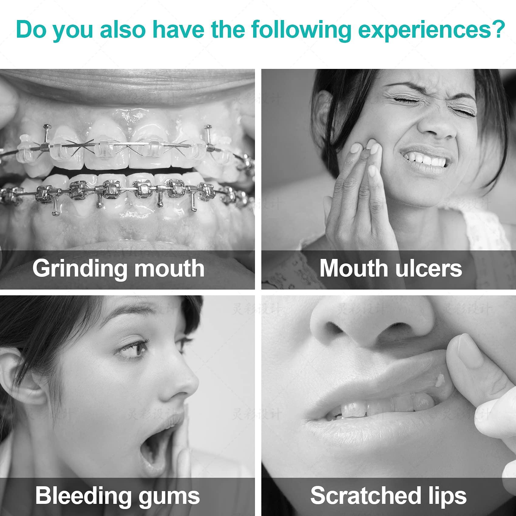 Annhua Annhua Orthodontist Braces Wax Ortho Dots 10 Pack for Aligners, Braces Wearer, Brackets, Invisible-lingers, Dental Orthodontic Wax Strips White - Unscented & Flavorless