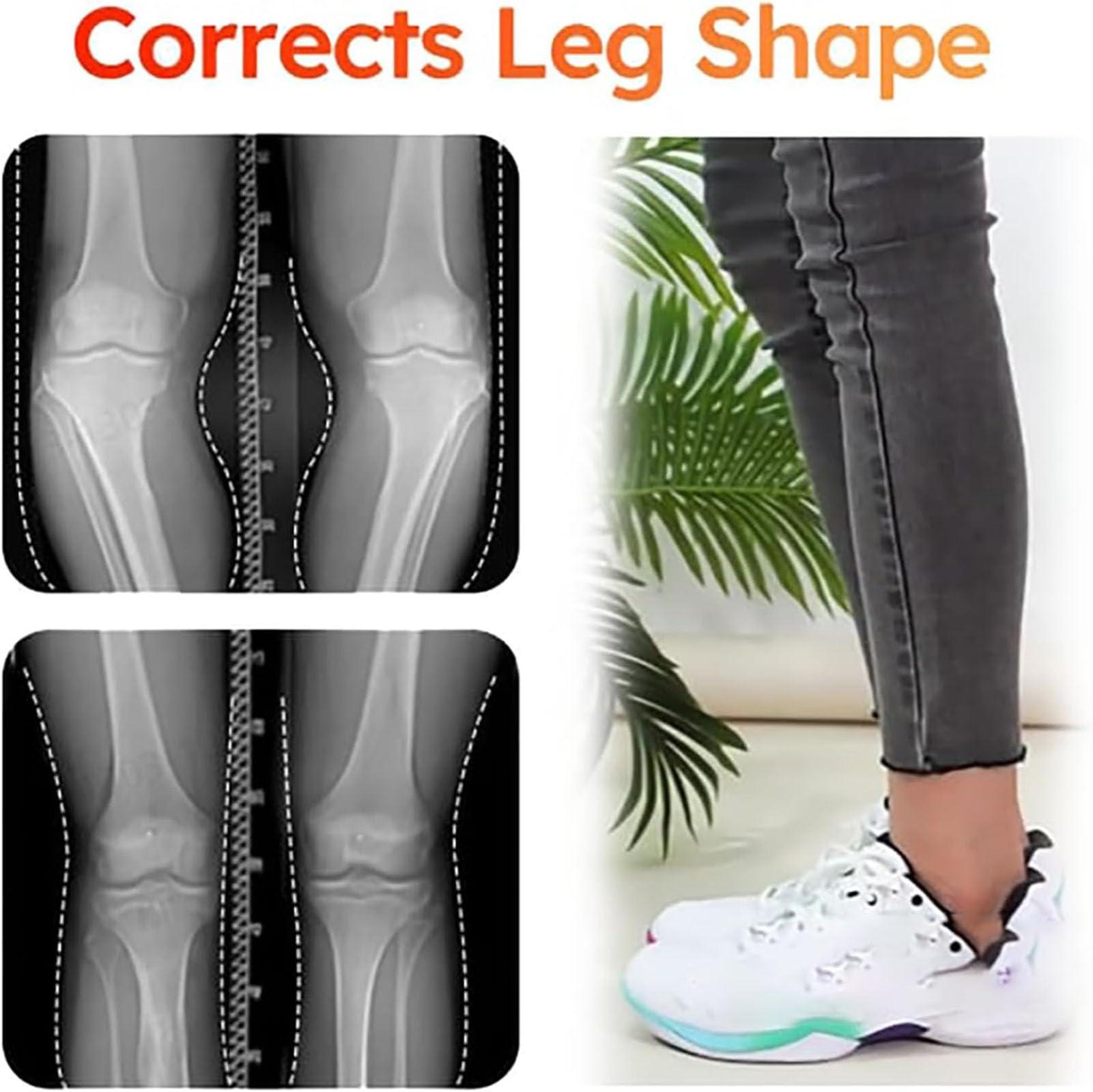 STALKLENE Steppers Insoles, Stepprs Insoles, Steppers Shoe Inserts, Steppers Insoles for Women, 4D Memory Foam Breathable Shock Absorption Insoles, Sweat-Absorbing (Gray, Men 6.5-7.5/Women 8-9)