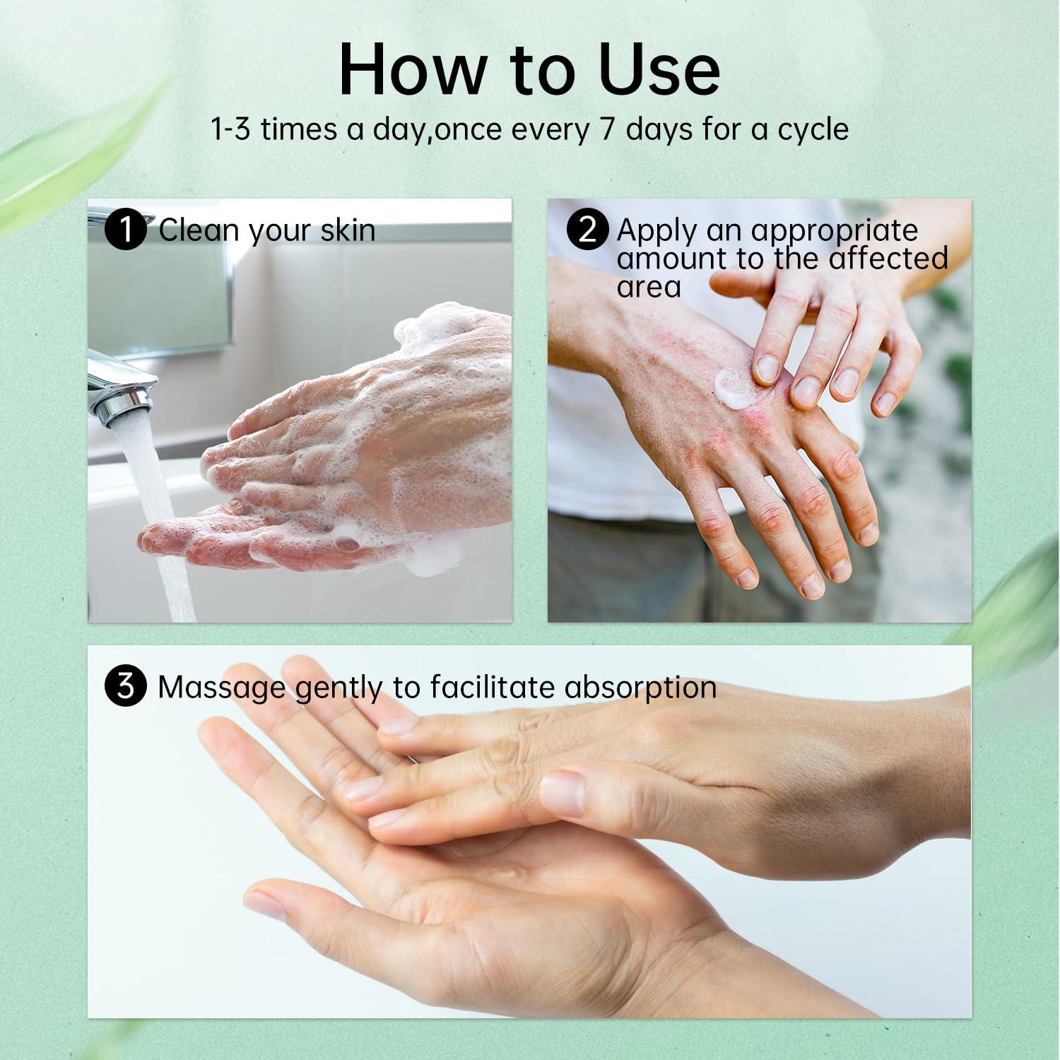 KoKoWill KoKoWill 2 Pcs Natural Chinese Herbal Eczema Cream, Eczema Treatment Ointment for Full Body Itching, Dryness, Redness, Acne, Pimples, Blisters, Crusting, Flaasking and Sensitive Skin