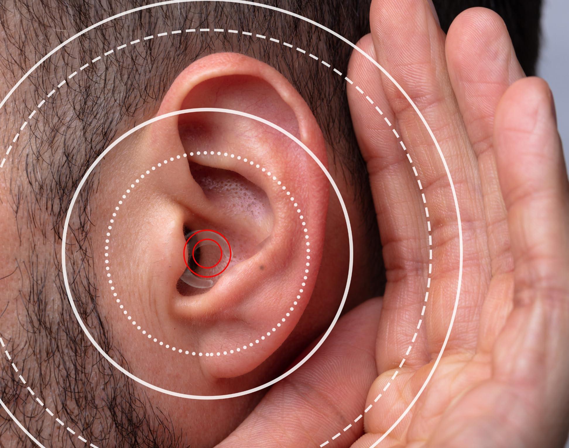 Invisabuds Invisabuds Clear Ear Plugs for Noise Reduction Super Soft, Reusable Hearing Protection in Flexible Silicone for Concerts, Noise Sensitivity - 4 Ear Tips in XS/S/M/L Around 26dB Noise Reducing