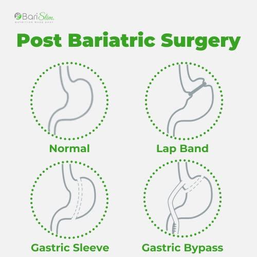 BariSlim BariSlim Advanced Chewable Bariatric Multivitamin Tablets - Bariatric Vitamin and Supplement for Post Bariatric Surgery Including Gastric Bypass and Gastric Sleeve | Wild Cherry (60 Count)