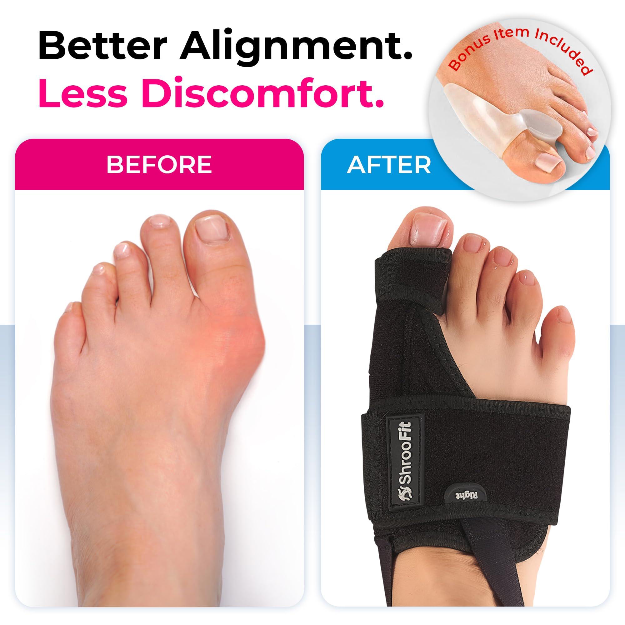 ShrooFit Effective Bunion Corrector for Women and Men | Relieve Pain, Straighten Toes, and Correct Bunions | Orthopedic Toe Straightener | Best Bunion Corrector for Lasting Relief
