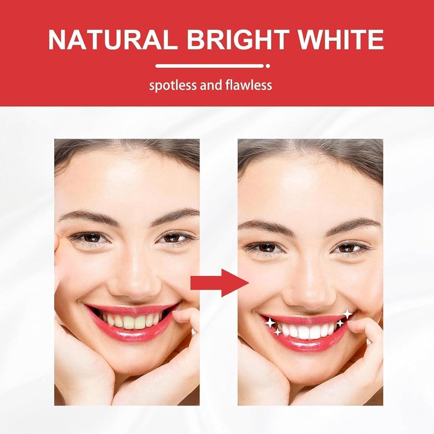HEKEWER SP 10 Probiotic Toothpaste, SP-10 Brightening Super Probiotics Whitening Toothpaste, SP 10 Toothpaste, Fresh Breath, Super Probiotic-6, Deep Cleaning Care Toothpaste (3PCS)