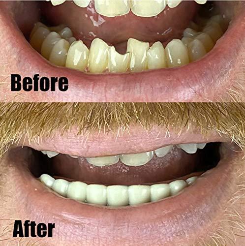 Instant Smile Instant Smile Comfort Fit Flexible Lower Teeth