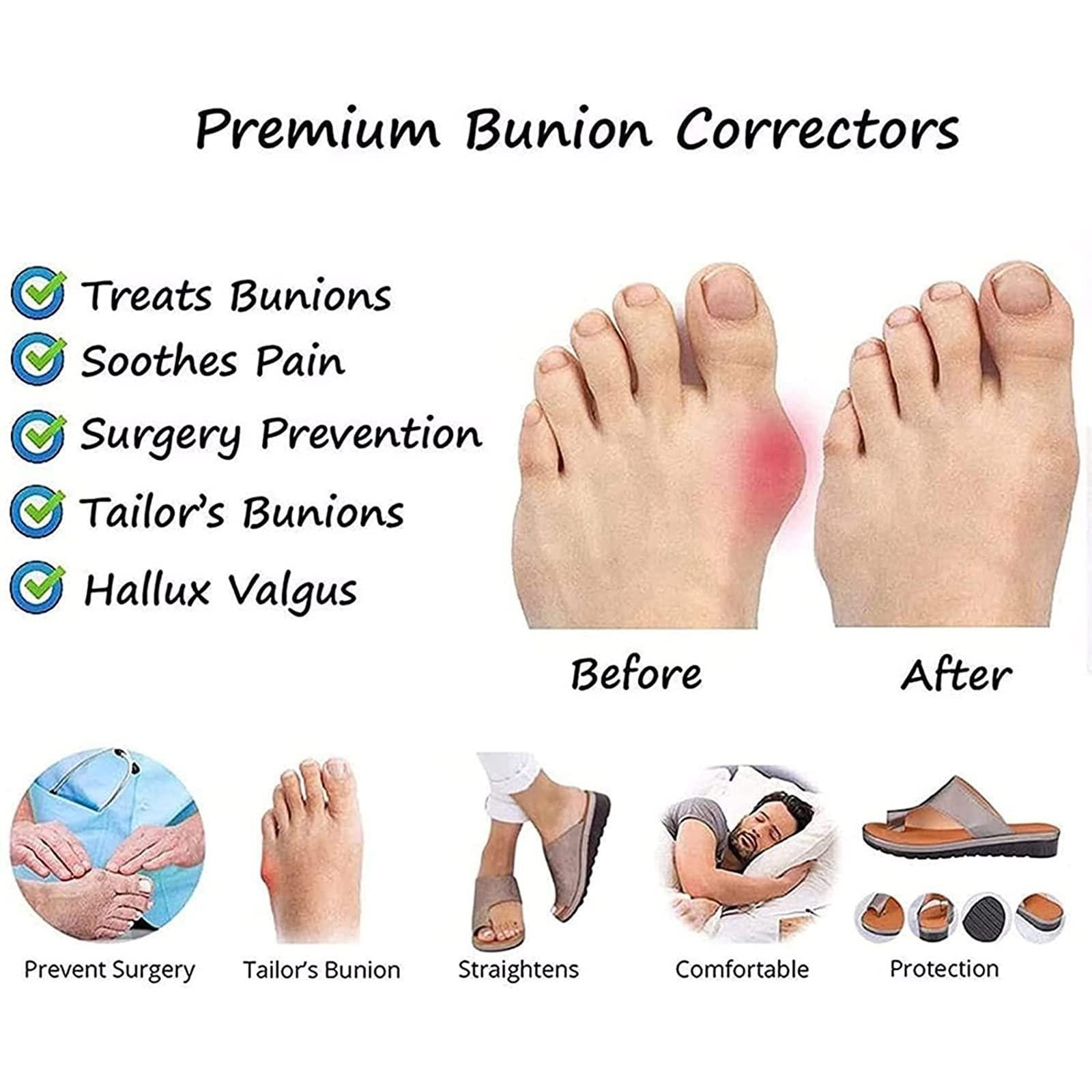 CLSQLXYJZC Men\'s Bunion Correction Sandals, Summer Comfy Flat Clip Toe Bunion Corrector Beach Walking Shoes, for Orthopedic Large Toe Bone Correction Sandals (Color : Black, Foot length : 25.5cm)