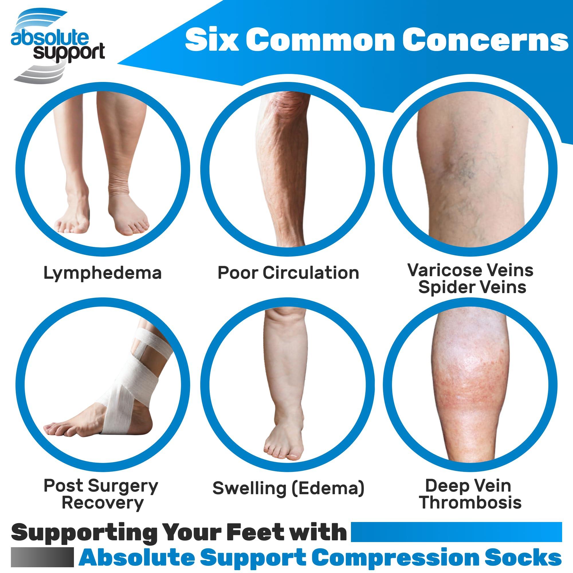 ABSOLUTE SUPPORT ABSOLUTE SUPPORT (3 Pairs) Opaque Knee High Graduated Compression Socks for Women and Men 20-30mmHg | For Swelling, Edema, Sclerotherapy, Diabetic - Black, Small - A501BL1-3