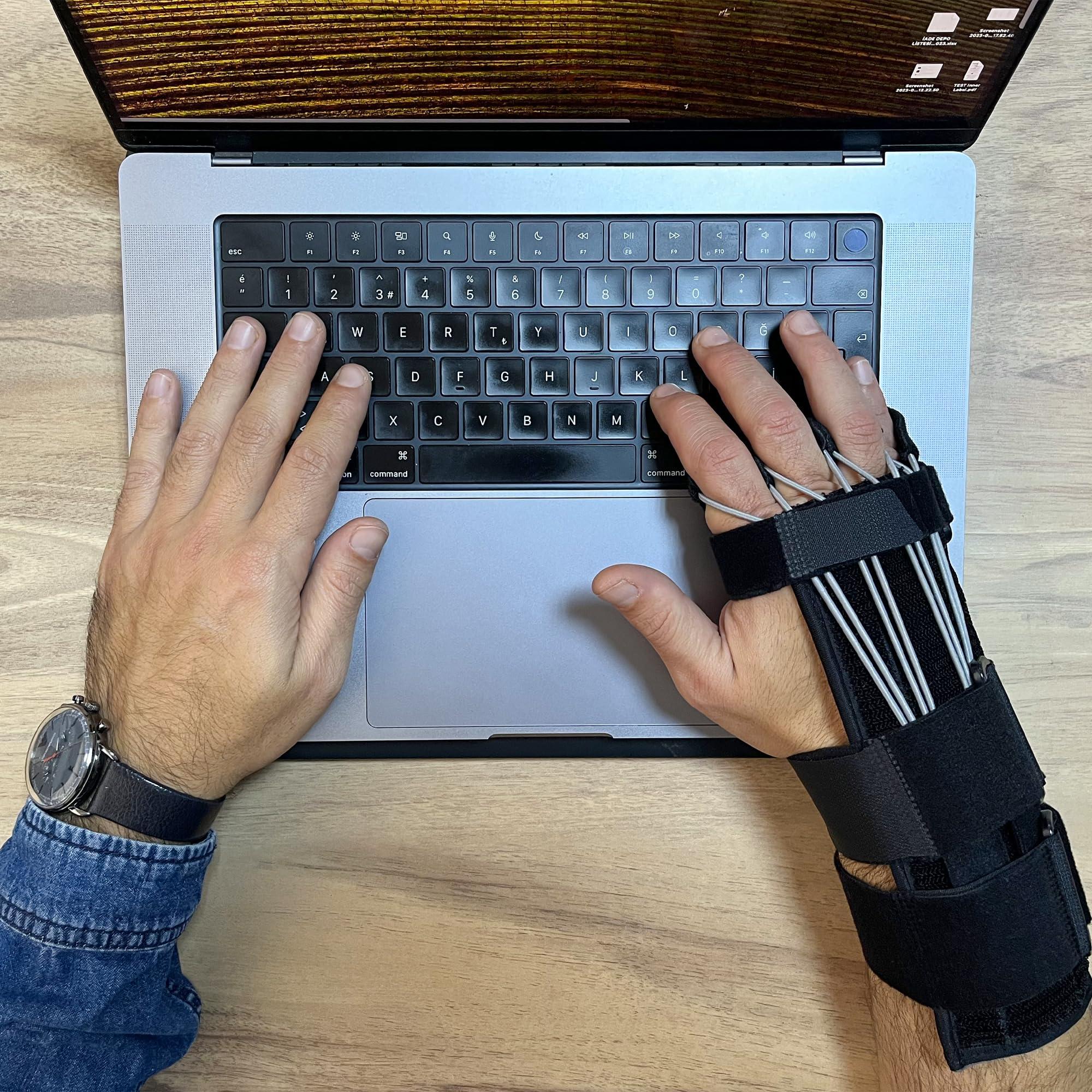 Pucka Pucka Radial Nerve Palsy Splint Adjustable Dynamic Drop Wrist and Finger Splint for Pain Mcp Arthroplasty Recovery Stroke Brace - Fits Right or Left Hand Splint