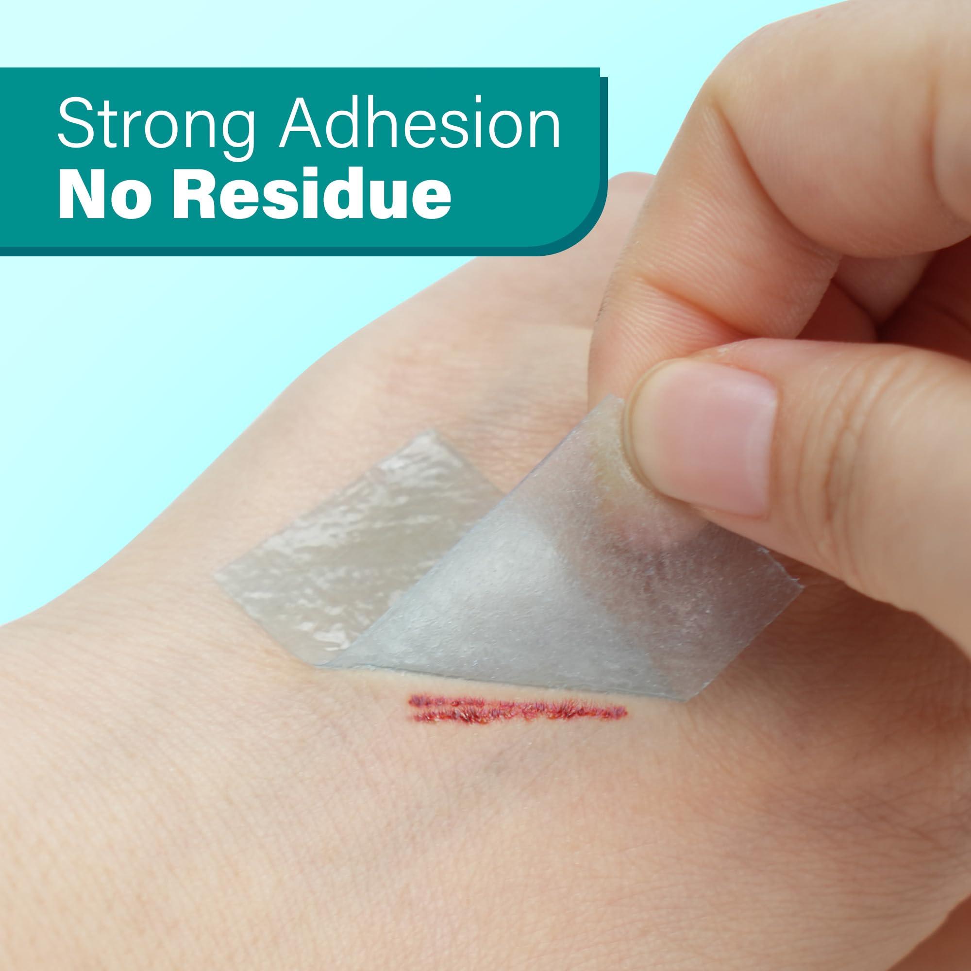 LotFancy LotFancy Medical Silicone Tape, 2Rolls 1”×5.5 Yds, Waterproof Adhesive Surgical Tape, Soft Skin Tape for Surgery First Aid, Wound, Bandage and Sensitive Skin