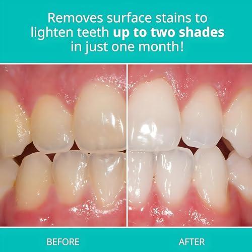 Opalescence Opalescence Whitening Toothpaste Travel Size 1 Ounce (2 Pack) Fluoride Teeth Whitening Toothpaste, Mint Flavor 402-2