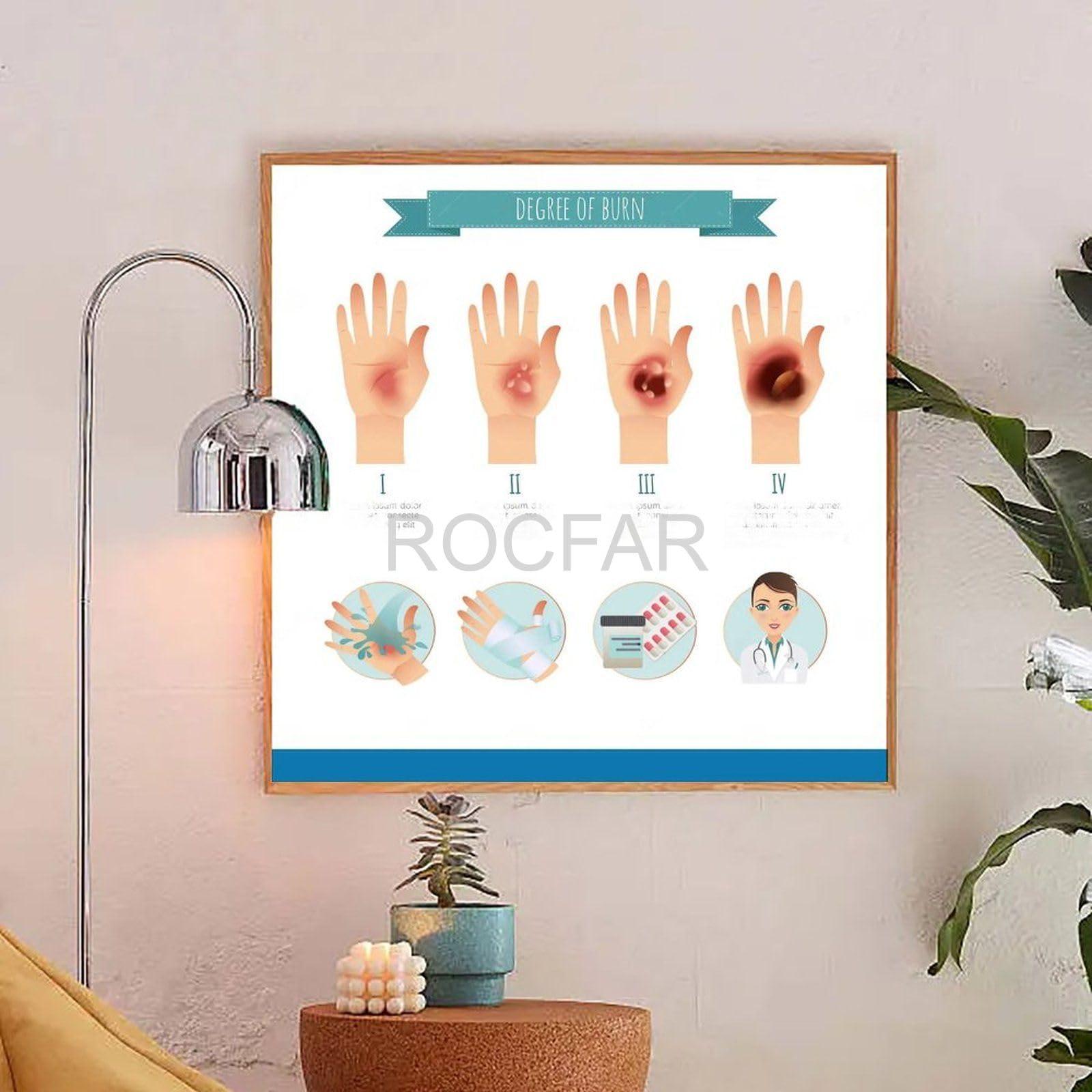 PRIMUZ First Aid Knowledge Poster Skin Burn Measures Procedure Emergency First Aid Knowledge Guide Canvas Poster Wall Art Decor Print Picture Paintings for Living Room Bedroom Decoration Frame-style 8x8inch(