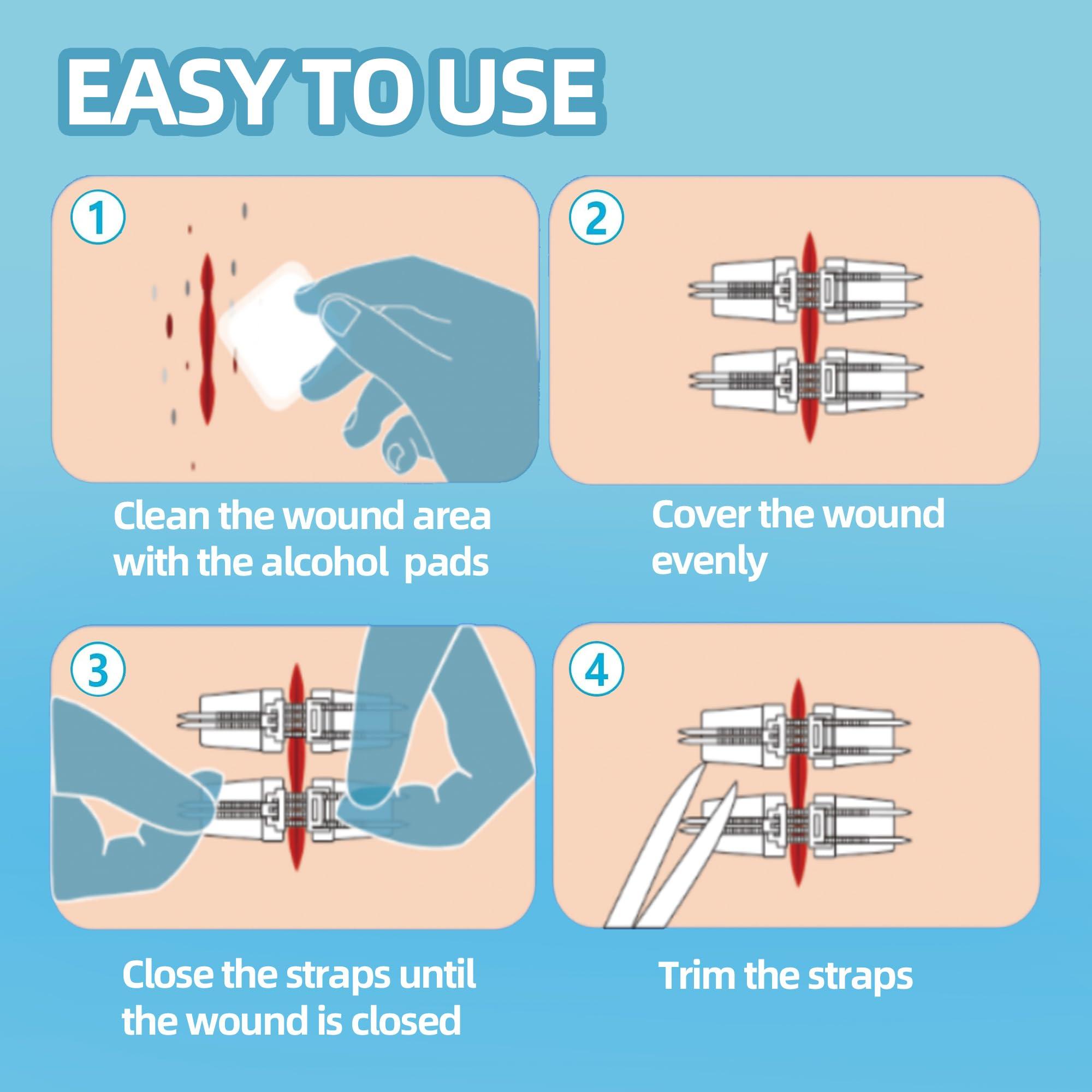 Longmed Longmed Emergency Wound Closures - 10 Pcs Zipper Wound Closure Device Painless Stitch Sutures Laceration Repair Without Stitches Adhesive Bandages for First Aid Wound Care(Factory Direct Sale)