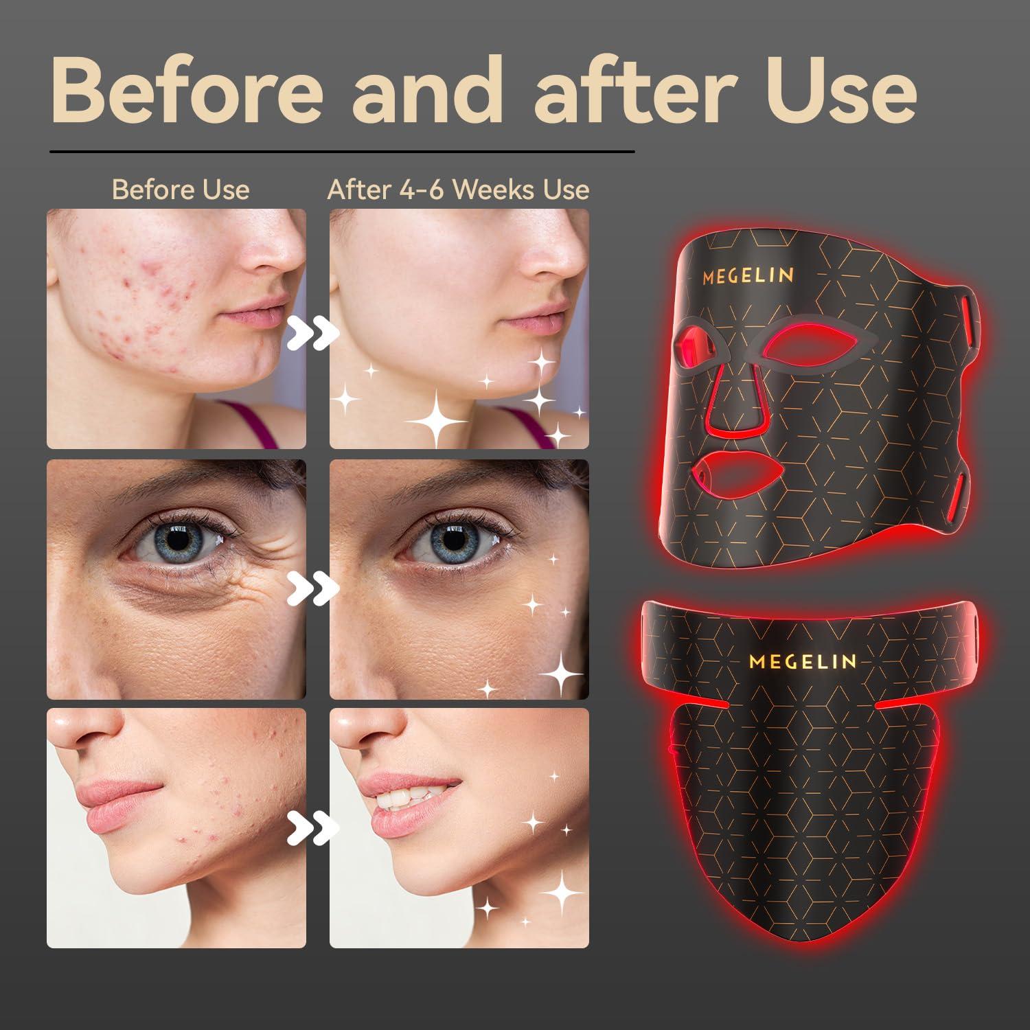 MEGELIN MEGELIN Led Red Light Therapy Mask,7 Colors Led Light Therapy Facial & Neck Mask