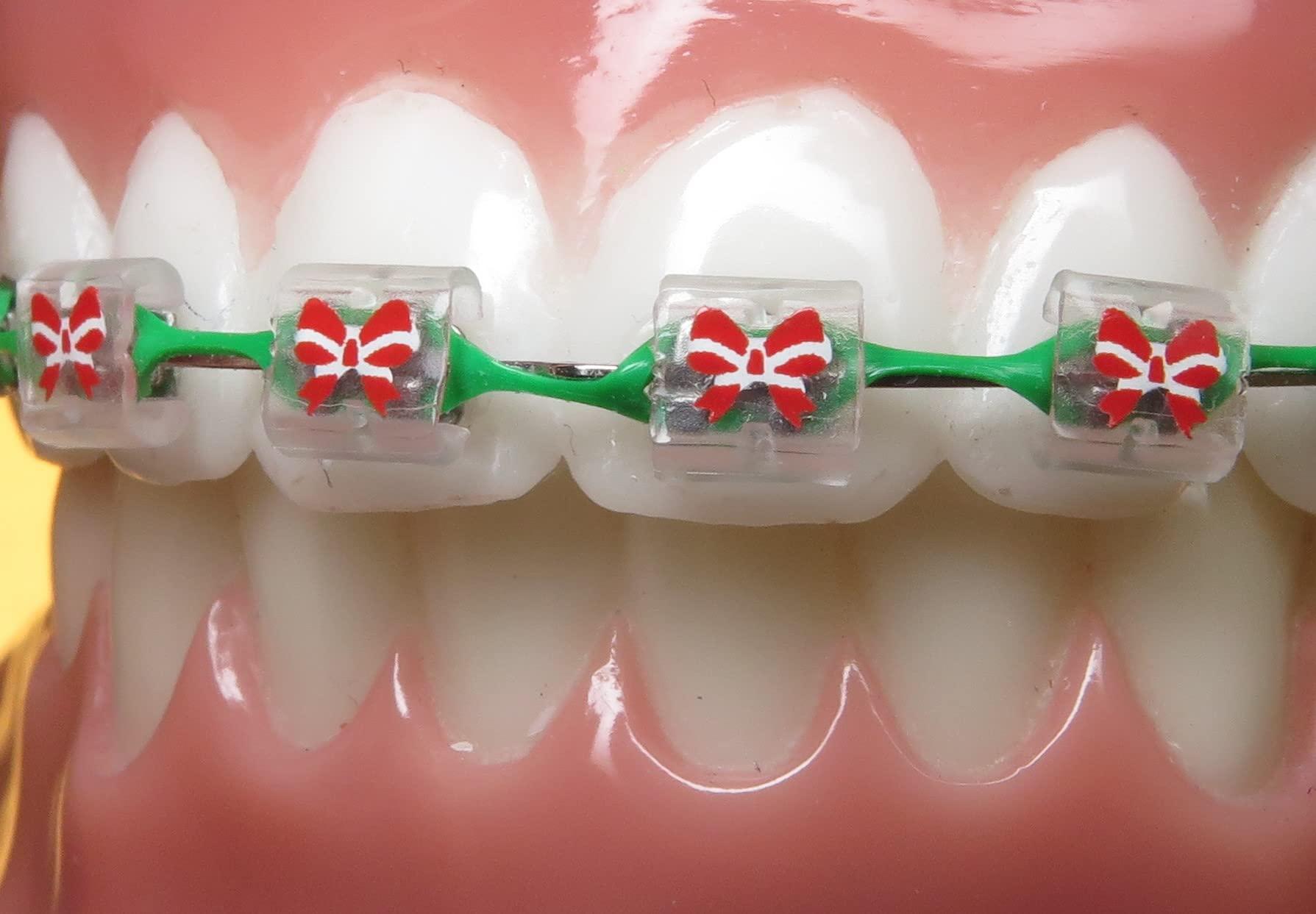 Snapcaps Snapcaps Braces Bumper Cover, Orthodontic Bracket Wax Substitute, Alternative Snap-on Braces Guard Braces Accessories 10 pack (Bow)