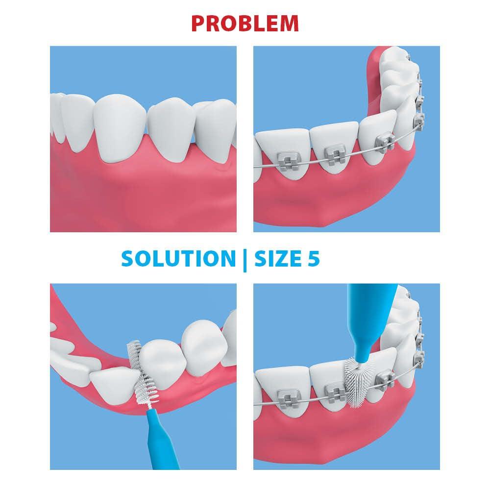 Piksters Piksters Interdental Brushes, 40 pk, Size 5, Interdental Tooth Brush for Large Gaps, Gum Soft Bristles for Plaque Removal, Safe for Braces