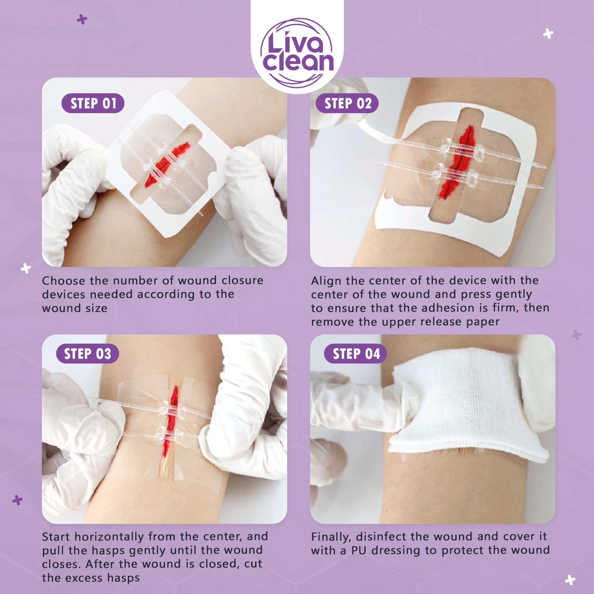 LivaClean (6 CT) 2.3 X 2.3 Butterfly Closures - Wound Closure Strips - Zip Stitch Wound Closure Butterfly Bandaids Adhesive Steri Strips Injury Closuring Glue Bandages Sutures