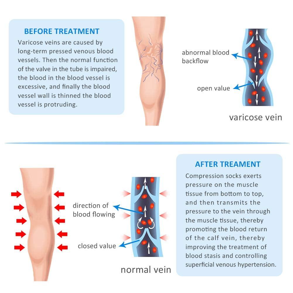 XUANSHOW 20-30mmHg Compression Pantyhose for Women, Medical Compression Stockings, High Waist Opaque Compression Tights for Lymphadema Edema, Swelling, Varicose Veins, Support Hose for Teacher Doctor (M,