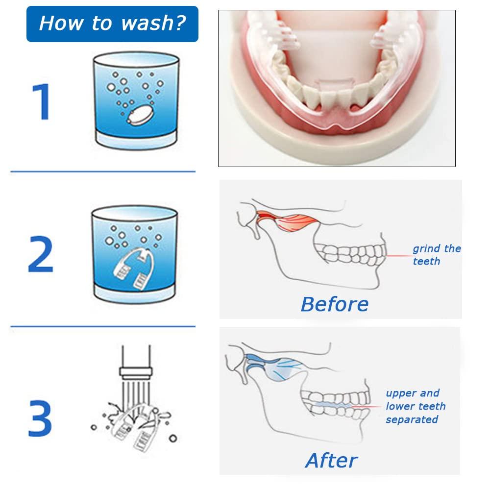 Hain Mouth Guards for Teeth Grinding, Dental Night Protector for Bruxism Clenching, Tmj, Snoring, No Color Additive,Custom Fit (4pcs)