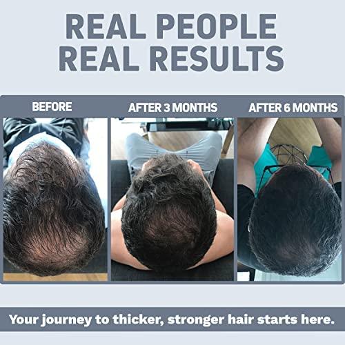 Herbtonics Foli-Tonic DHT Blocker & Hair Loss Supplement | Hair Thinning Treatment & Promotes Healthy Thicker Hair Growth - Prostate Support Supplement for Men\'s Health - Saw Palmetto & Beta Sitosterol Formula