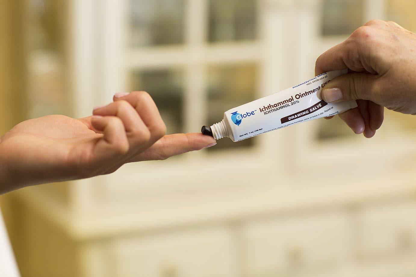 Globe Globe Ichthammol Ointment 20% (Drawing Salve) 1 OZ - Soothing Skin Relief, Treatment of Eczema, Acne, Boils, Splinters, Bee Stings - Maximum Strength