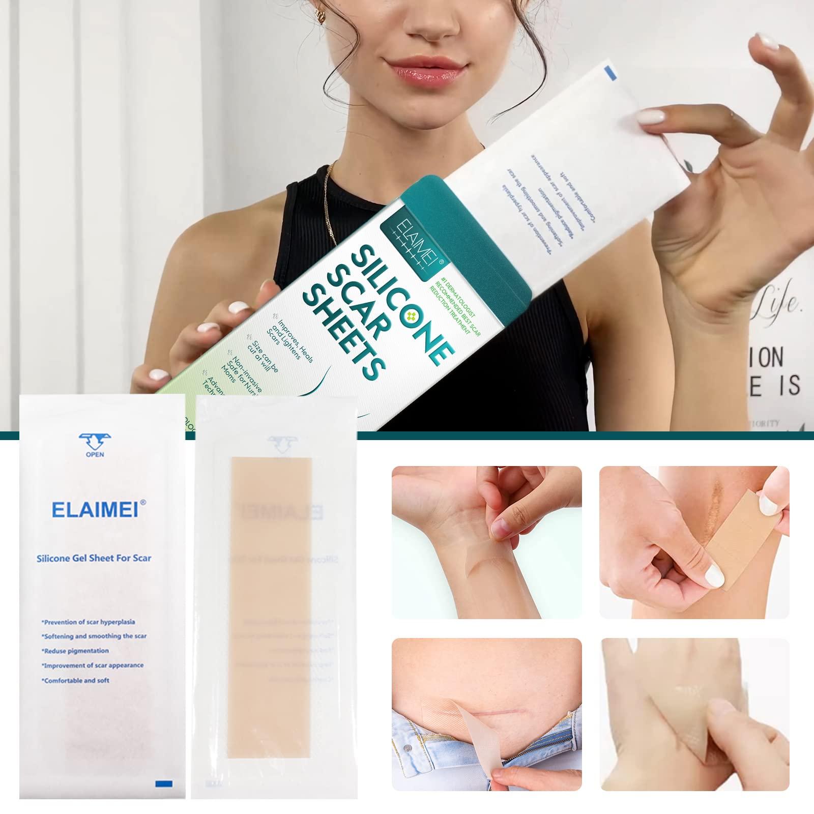 RTBYUE Silicone Scar Sheets,Professional Silicone Tape for Scars(16 pads-5.9x 1.6),Silicone Scar Tape,Scar Removal Sheets,Silicone Scar Strips for Surgical Scars, C-Section, Surgery, Burn, Keloid, Acne