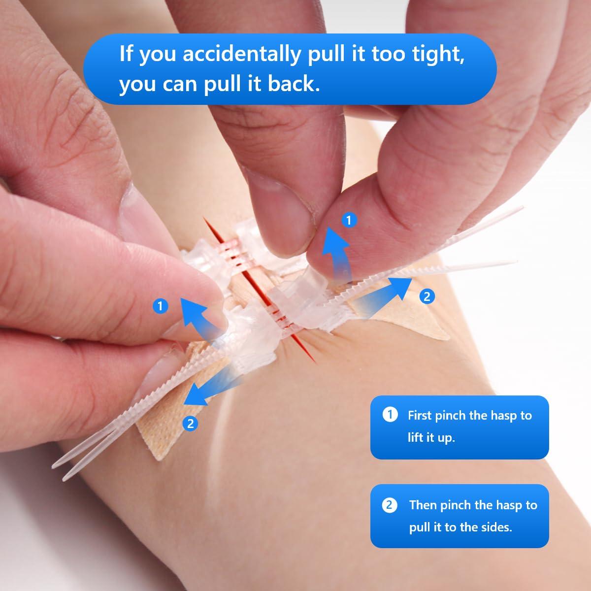 Longmed Longmed Emergency Wound Closures - 10 Pcs Zipper Wound Closure Device Painless Stitch Sutures Laceration Repair Without Stitches Adhesive Bandages for First Aid Wound Care(Factory Direct Sale)