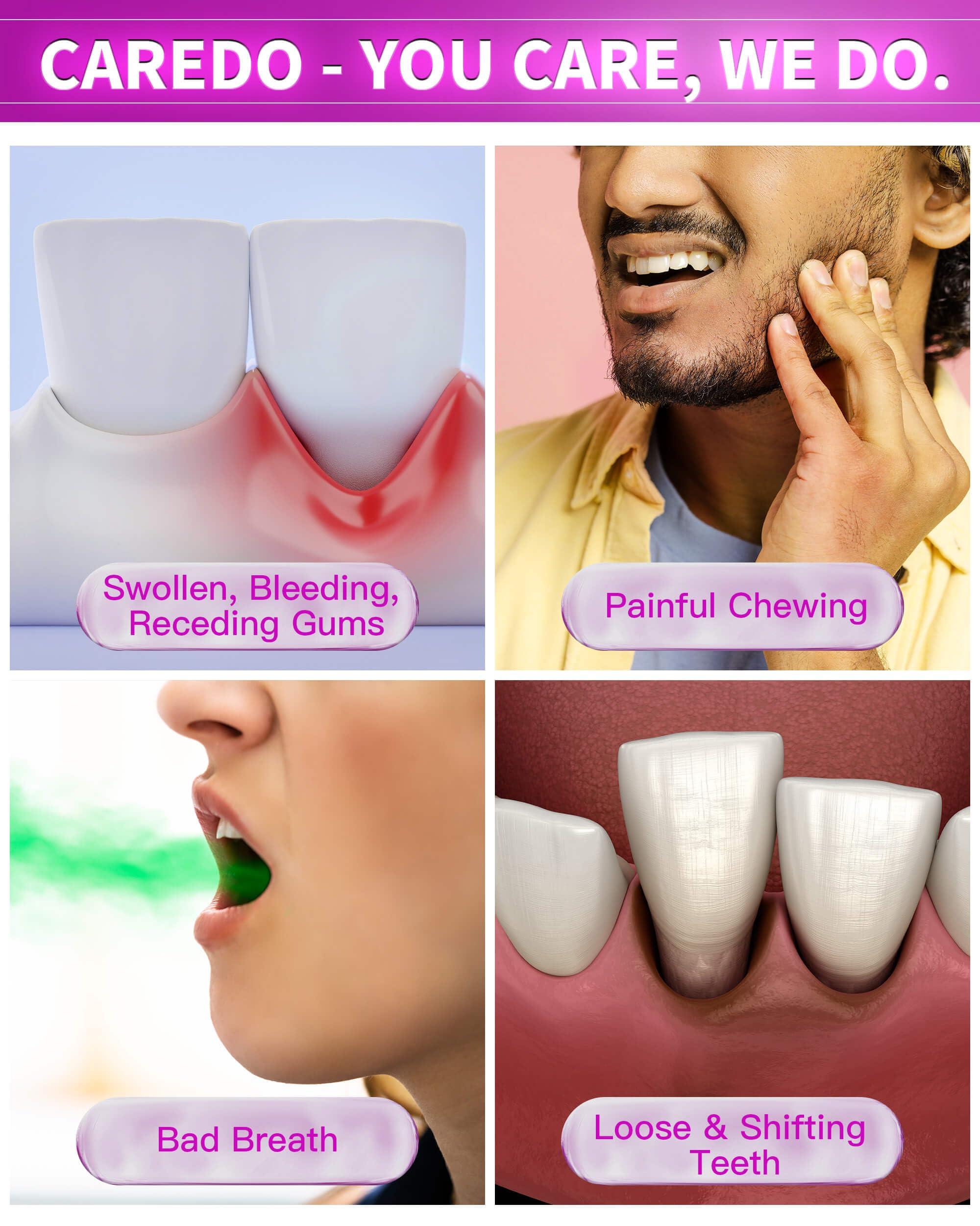 CAREDO Medicine Toothpaste Healing Early-Mid Periodontitis Treatment at Home, Gum Repair for Receding Gums, Gum Disease & Gingivitis Treatment, Periodontal Disease Treatment Hydroxyapatite Toothpaste, 3.52OZ