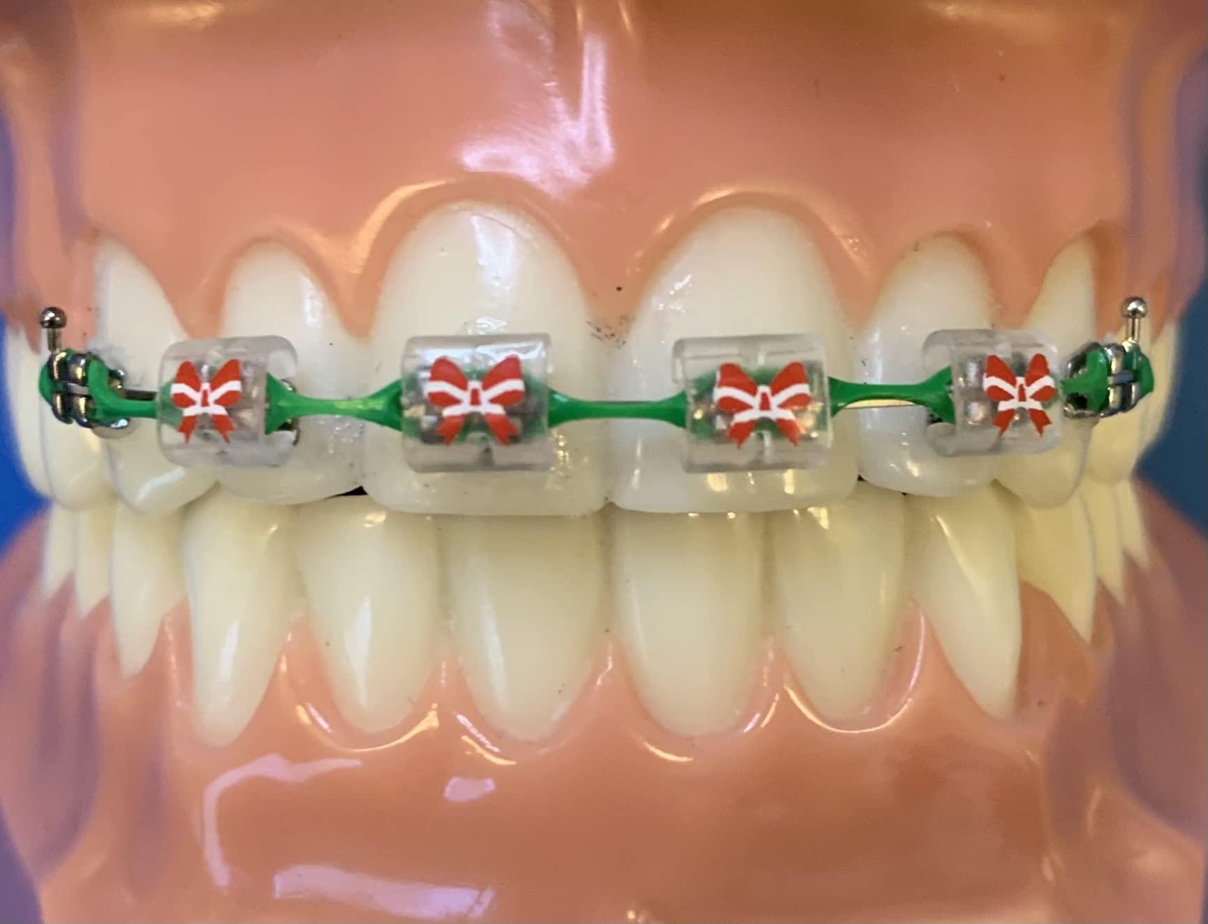 Snapcaps Snapcaps Braces Bumper Cover, Orthodontic Bracket Wax Substitute, Alternative Snap-on Braces Guard Braces Accessories 10 pack (Bow)