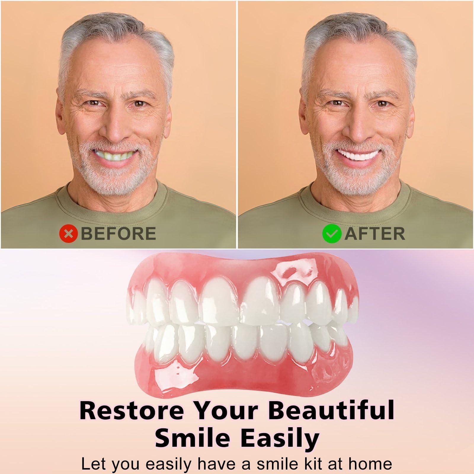 HYZX Upper and Lower Veneer, Dentures for Women and Men, Fake Teeth, Natural Shade! Fix Your Smile at Home Within Minutes!