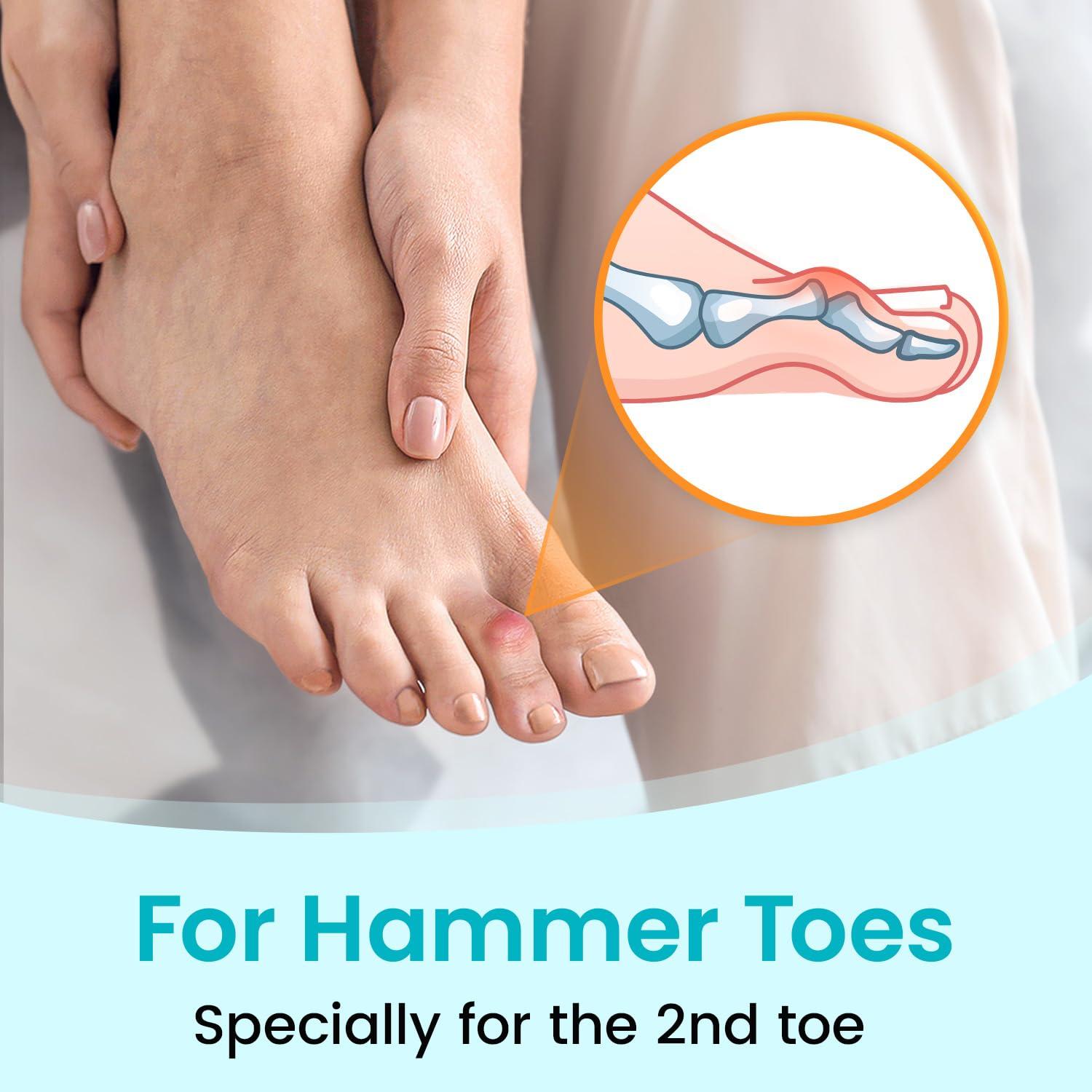 Pozpo Tech Hammer Toe Straightener Corrector Wrap for Women & Men, Hammer Toe Splint Support - 1 in package