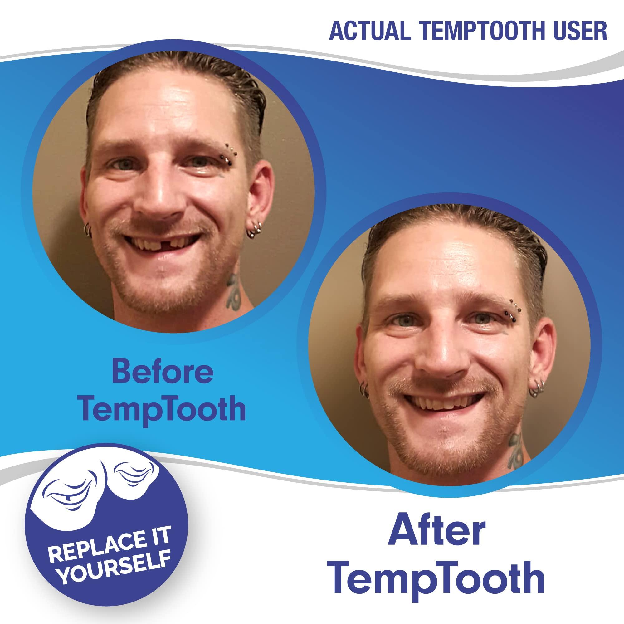 Temptooth Temptooth #1 Seller Trusted Patented Temporary Tooth Replacement Product