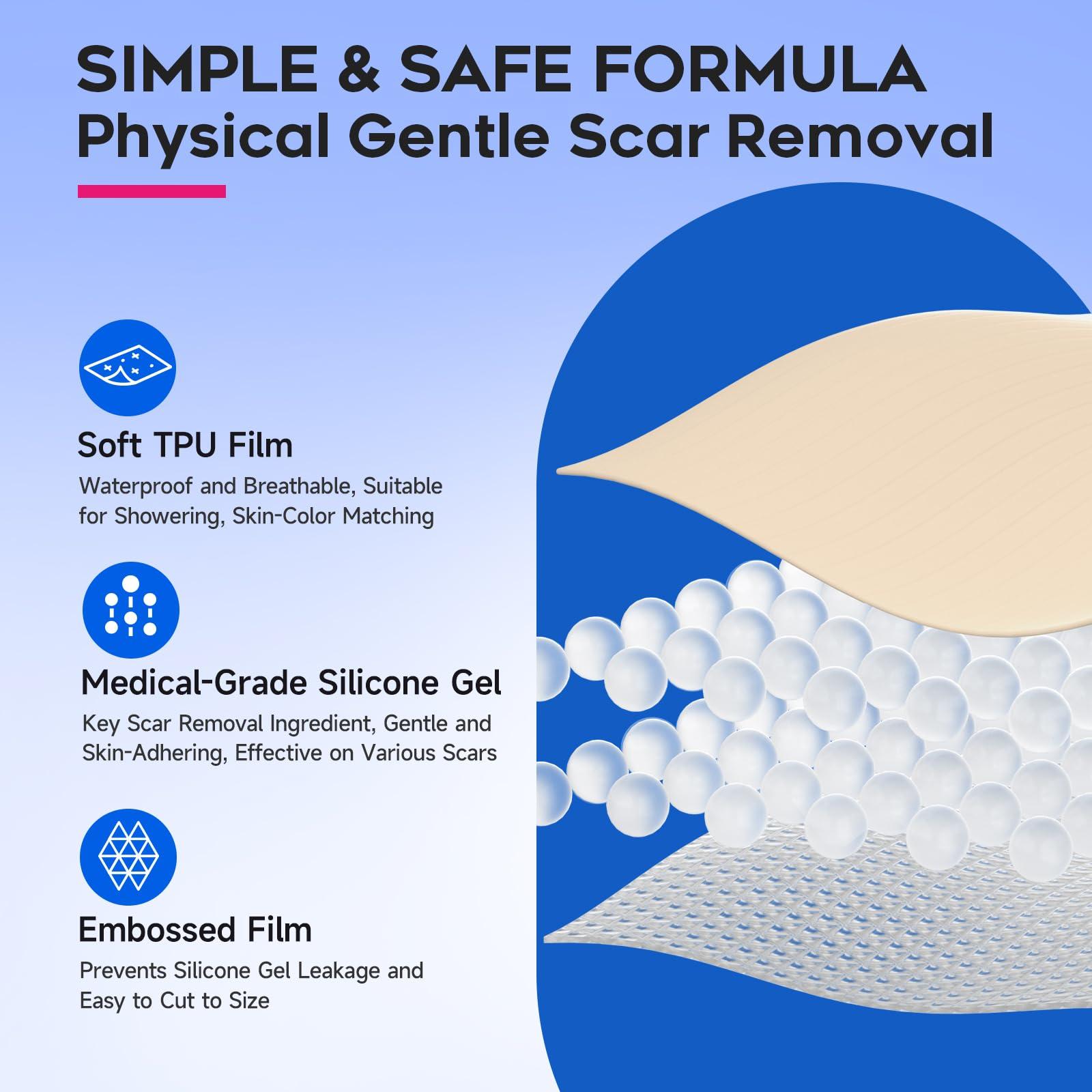 EzonaCare EzonaCare Thicker Silicone Scar Sheets, Medical Grade Silicone Scar Tape Roll (118\" x 16\") Effective, Strong Stickiness, Scar Sheets for Surgical Scars, Keloid, C-Section, Burn, Acne