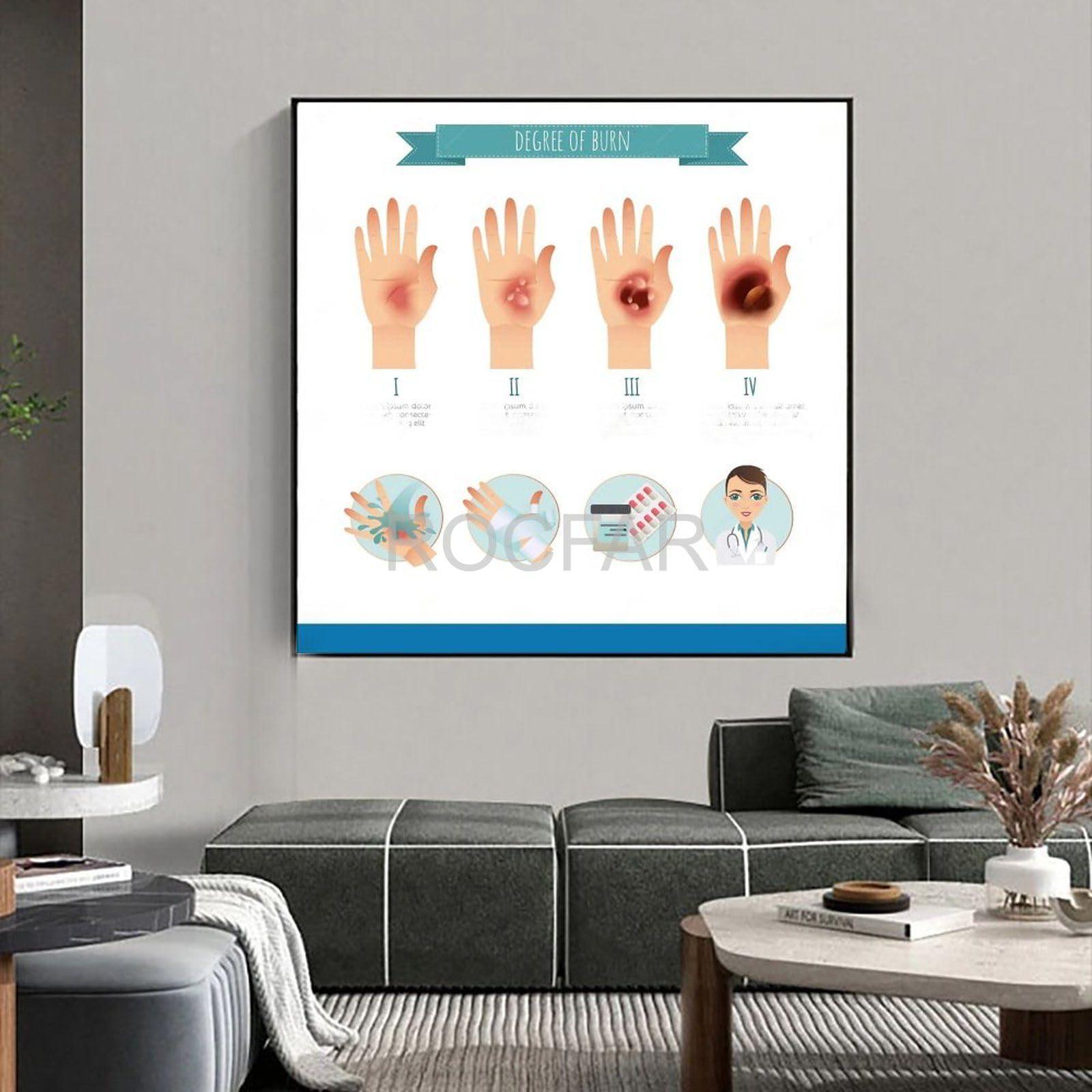 PRIMUZ First Aid Knowledge Poster Skin Burn Measures Procedure Emergency First Aid Knowledge Guide Canvas Poster Wall Art Decor Print Picture Paintings for Living Room Bedroom Decoration Frame-style 8x8inch(