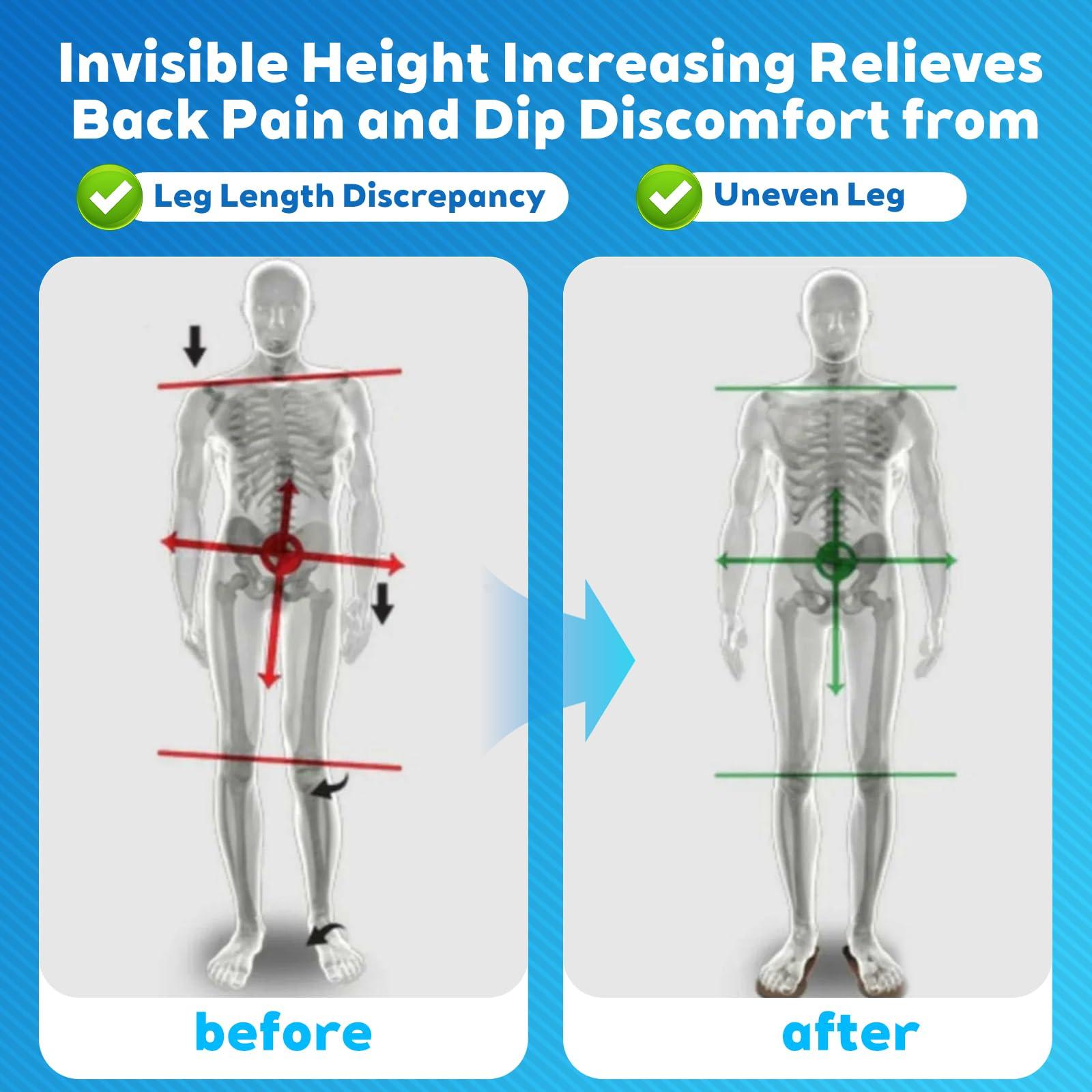 PrettSole PrettSole 5mm to10mm Heel Lifts(2 Layers), Height Increase Insoles for Leg Length Discrepancy - Large Shoe Lifts for Men, Shoe Inserts Comfort Half Foot Pads for Heel Pain - 1 Pair