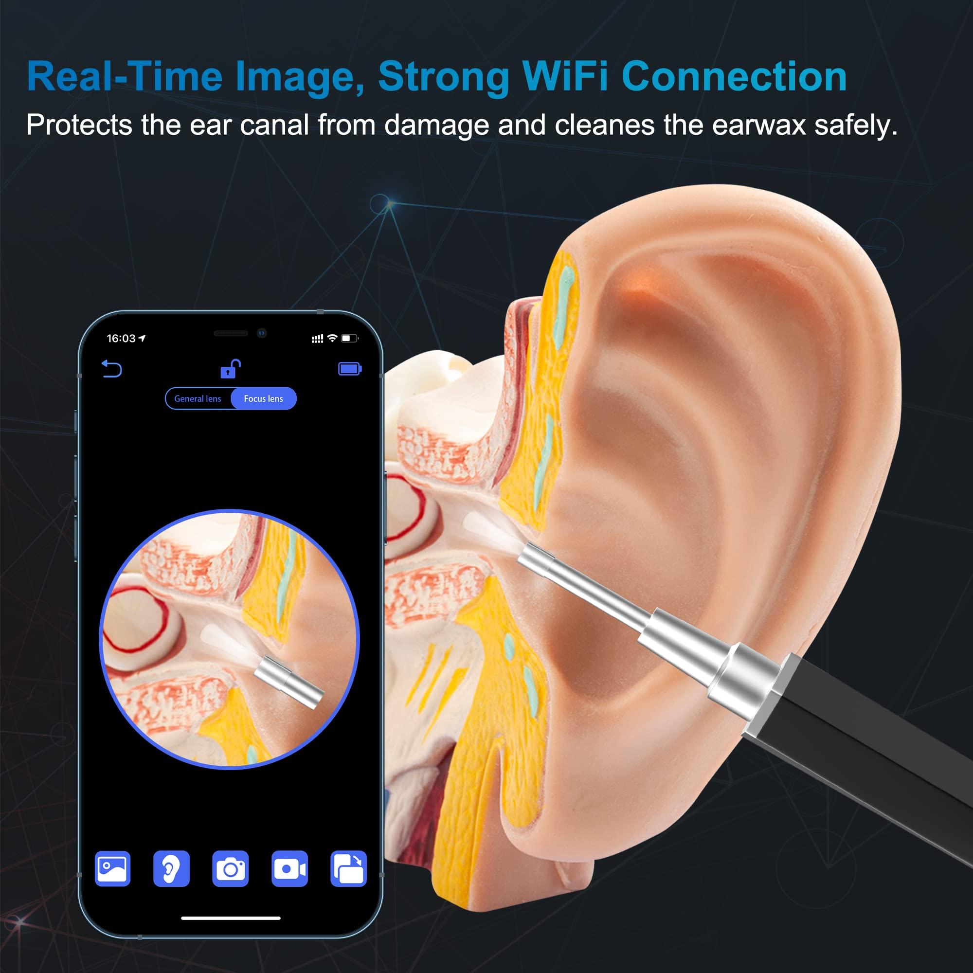 VANBAR Ear Wax Removal, Ear Cleaner with Camera Earwax Remover Tool, Ear Camera Otoscope kit with Light, Ear Wax Camera with 6 Ear Spoon for Kids, Adults & Pets