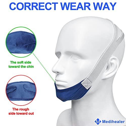 Medihealer 2 Packs Chin Straps for Users and Mouth Breathers - Anti Snoring Chin Strap for Men and Women,Chin Straps to Reduce Air Loss, Instant Mouth-Snoring Relief, Great Value Supplies by Medihealer.