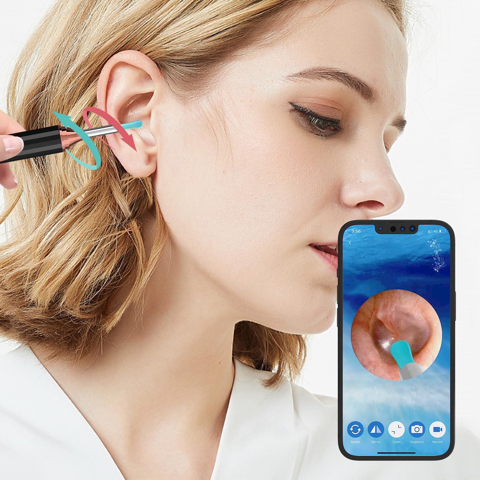 Docbraces Docbraces Ear Wax Removal,Ear Cleaner Tool with Ear Camera and Light,Earwax Removal kit with 4 Ear Pick,1080P Ear Camera Smart Visual Cleaning Kit for iOS&Android (Black)