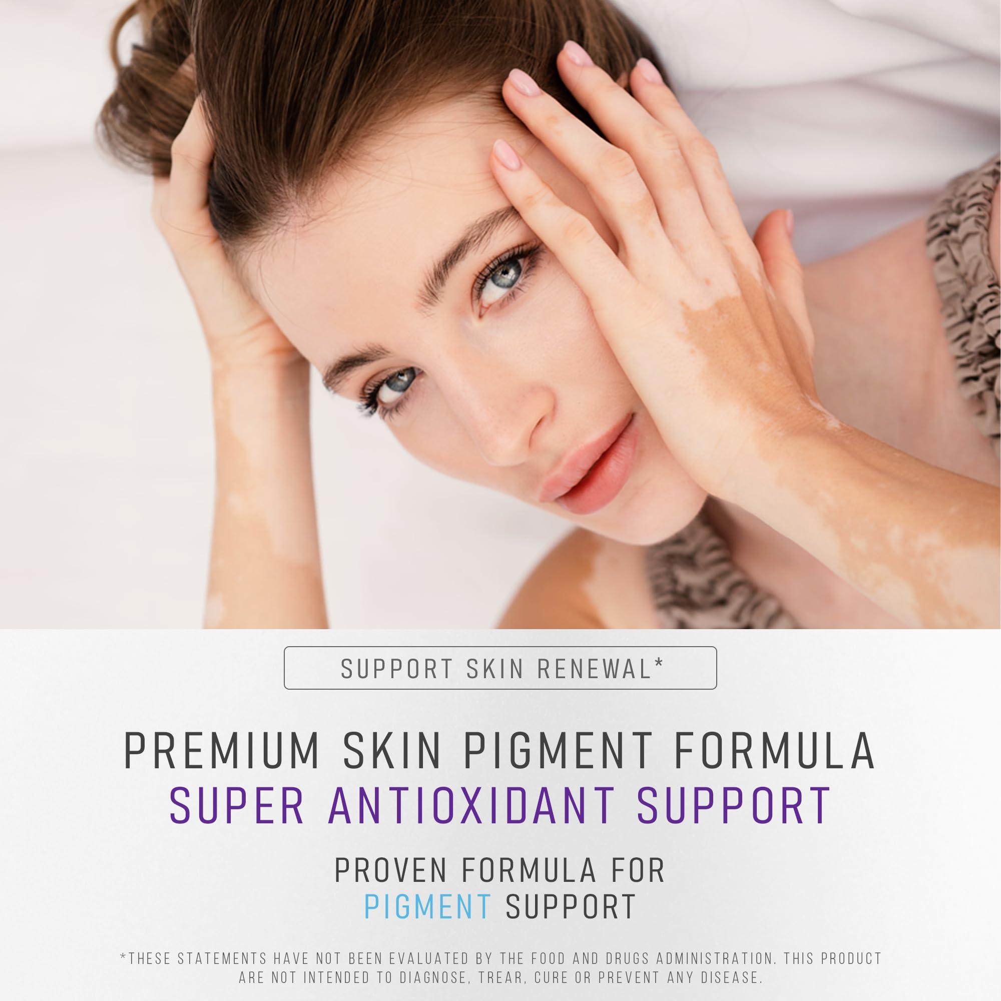 AURA VITAMINS AURA VITAMINS - Vitiligo Capsules 60 Count | 1 Month | Improve Skin Pigmentation Support and Reduce White Spots | Effective Vitiligo Supplement | Natural Solution for White Spots on Skin. (1)