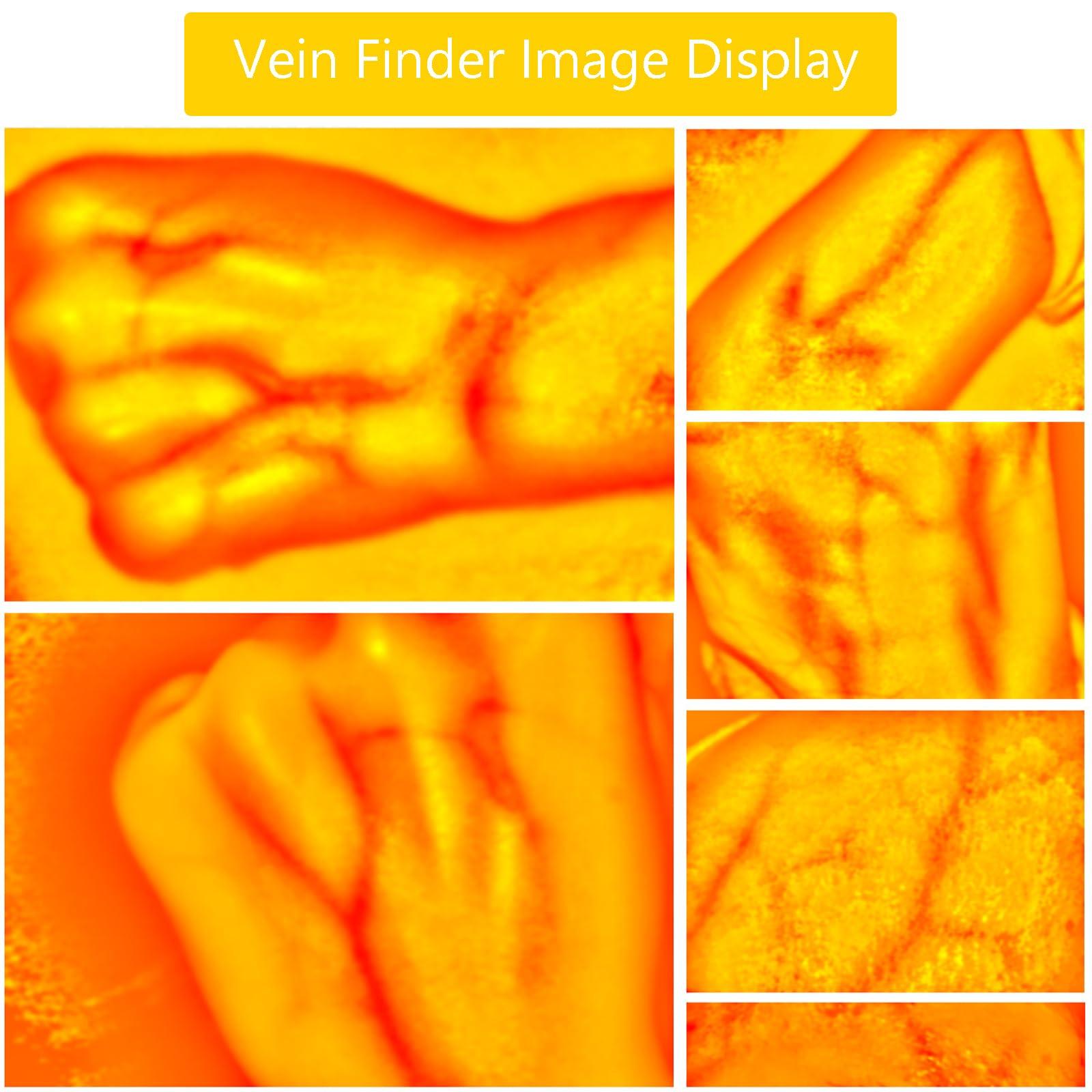 nLn Hope Vein Finder, Portable Blood Vessel Finder, Medical Vein Image Display Instrument, Infrared Vein Finder Viewer Light with 5 Modes for Elderly Adult Children Easy Finding Subcutaneous Veins