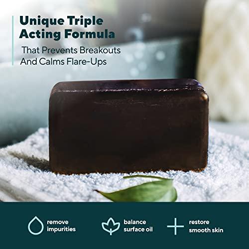 MARIE'S ORIGINAL Marie Originals Acne Bar Soap Cleanser for Face and Body | Acne Treatment with Bentonite Clay, Organic Oat Bran, Noni Fruit Powder, White Willow | Natural Body Wash for Pimples and Scars (1 Pack)