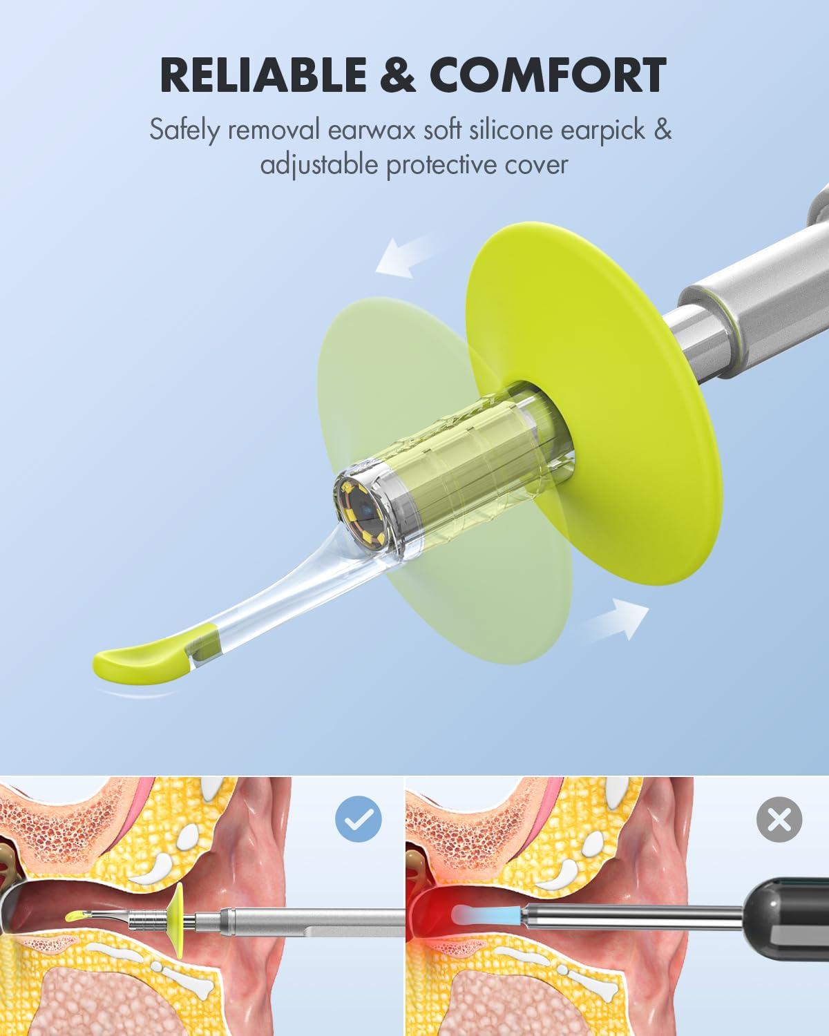 Anykit Anykit Digital Otoscope for Phone & Tablet, Ultra Clear View Ear Camera with Ear Wax Removal Tools, Video Ear Scope Otoscope with Light, Support Capture Photo & Record Videos