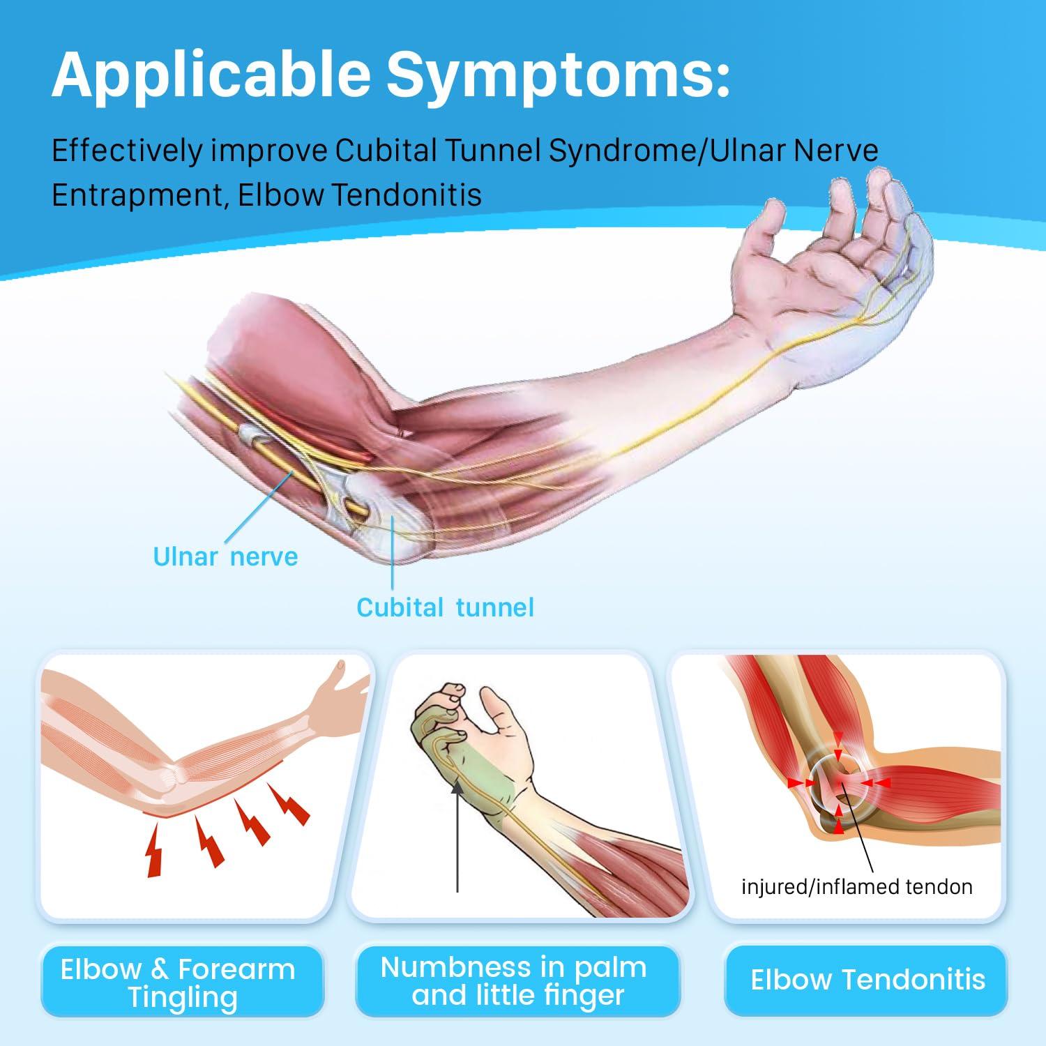 Sylong Elbow Brace Splint for Cubital Tunnel Syndrome, Ulnar Nerve Entrapment, Night Sleep Elbow Support with 3 Plates, Elbow Stabilizer for Tendonitis, Tennis Elbow, Elbow Pain Relief, Fit Men & Women-S/M