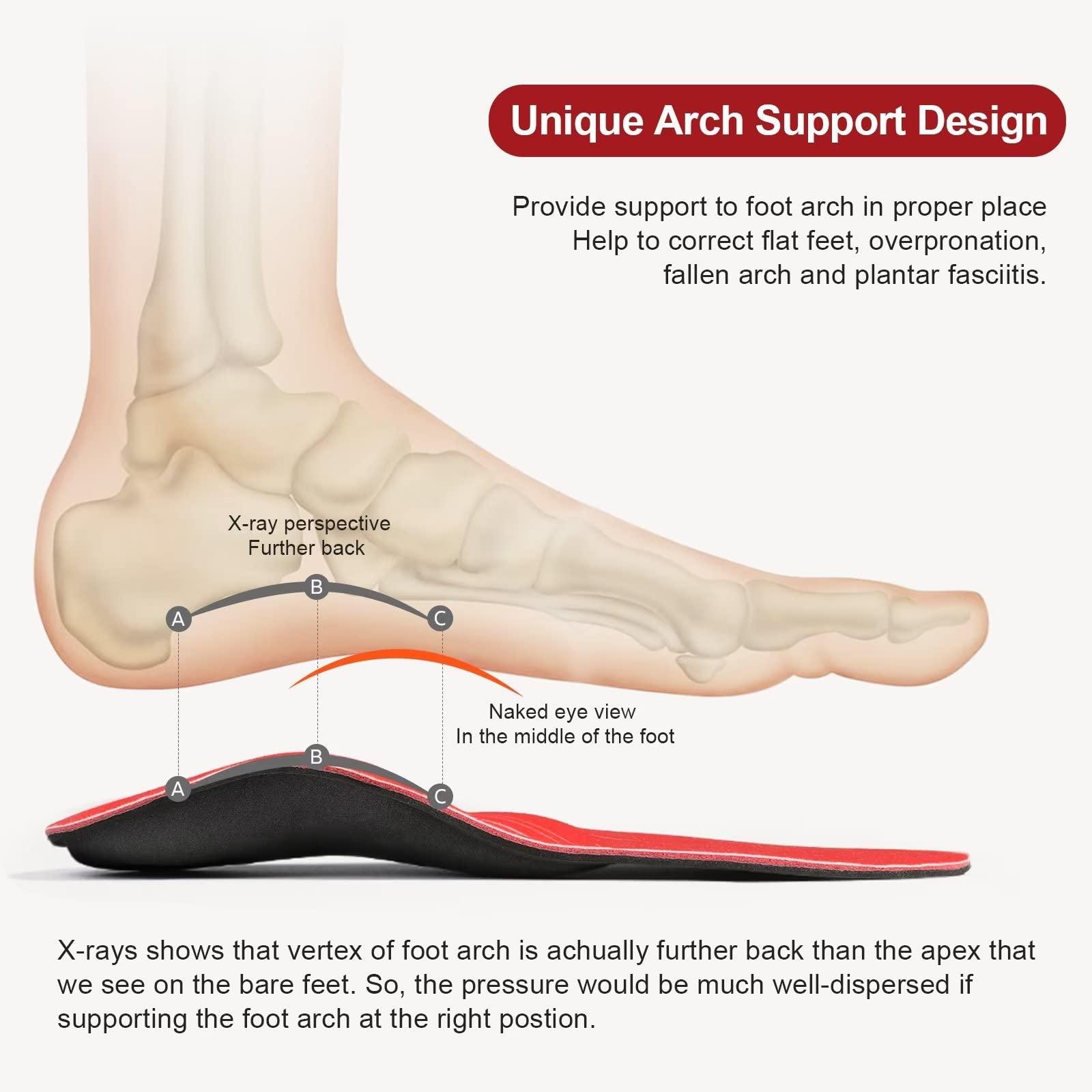 3ANGNI 3ANGNI Arch Support Insoles, Orthotic Insoles for Flantar Fasciitis Flat Feet Low Arch Pronation Metatarsalgia, High Arch Foot Support Orthopedic Insert Men Women (Men 12-12.5 / Women 14-14.5, Red)
