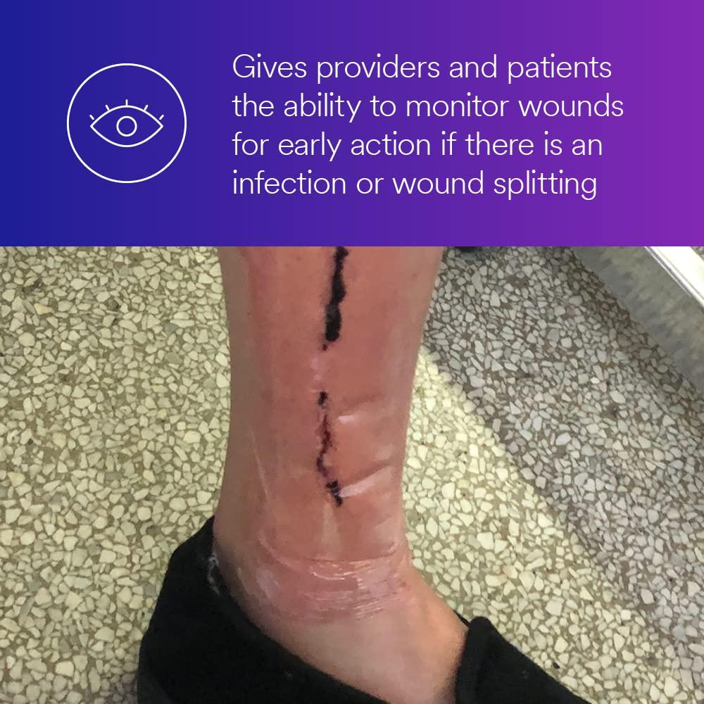 Tegaderm 3M Tegaderm Absorbent Clear Acrylic Dressing, 90800, Oval, 3 in x 3-3/4 in (7.6 cm x 9.5 cm), 10/CAR, 4 CAR/CS