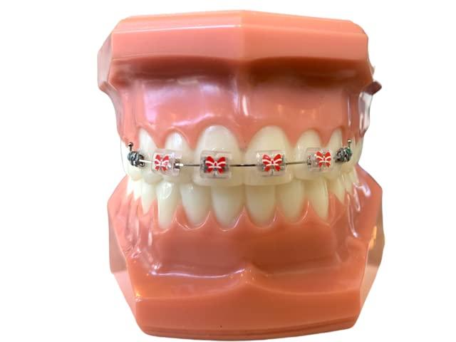 Snapcaps Snapcaps Braces Bumper Cover, Orthodontic Bracket Wax Substitute, Alternative Snap-on Braces Guard Braces Accessories 10 pack (Bow)